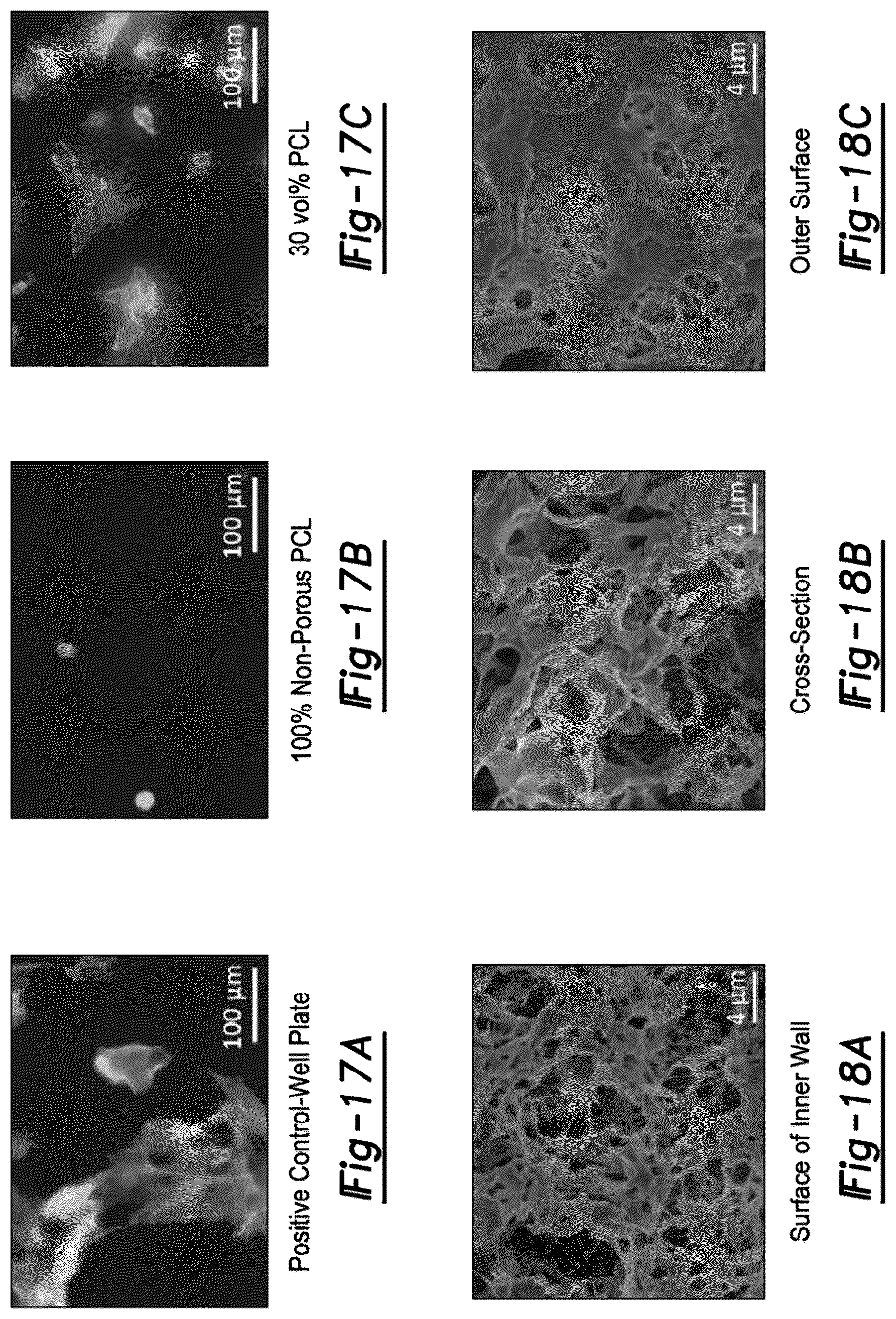 Patent US12377195 Figure 12 – Nerve repair scaffolds having high microchannel volume and methods for making the same