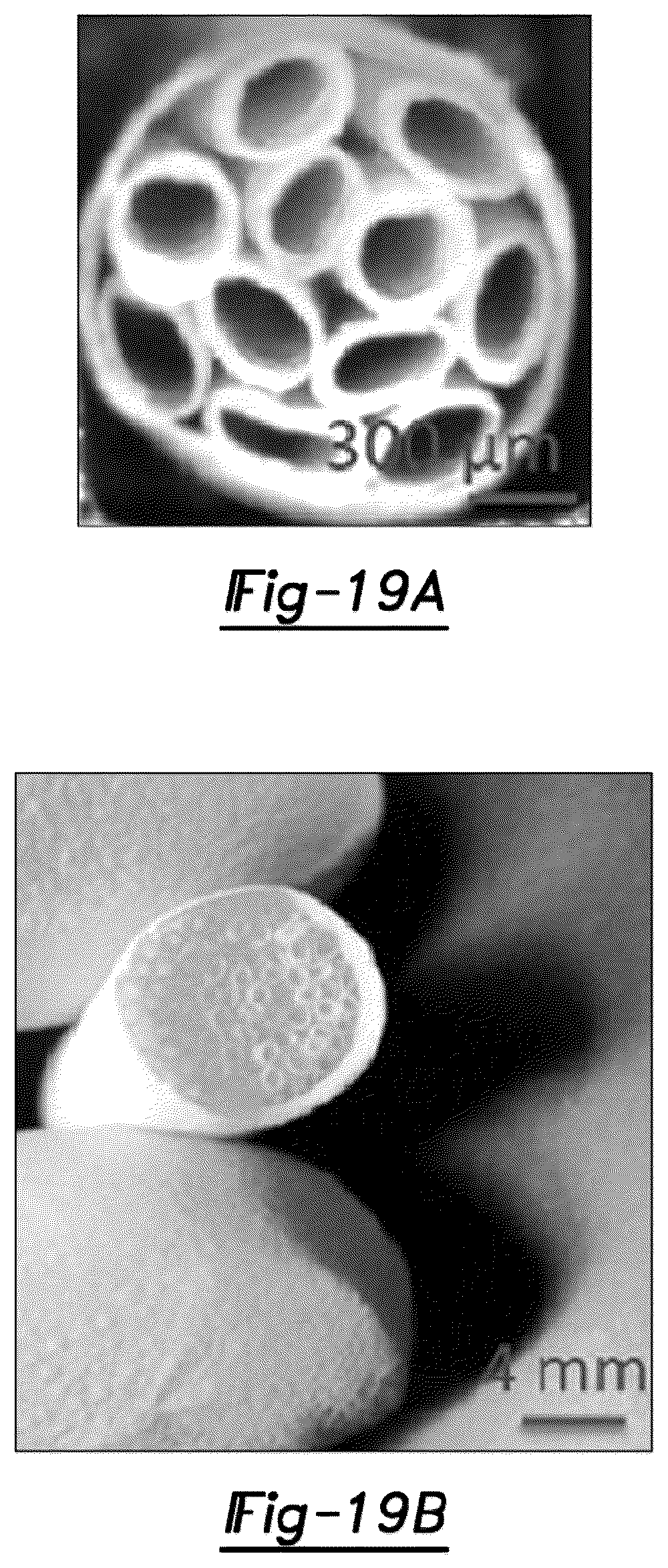 Patent US12377195 Figure 13 – Nerve repair scaffolds having high microchannel volume and methods for making the same