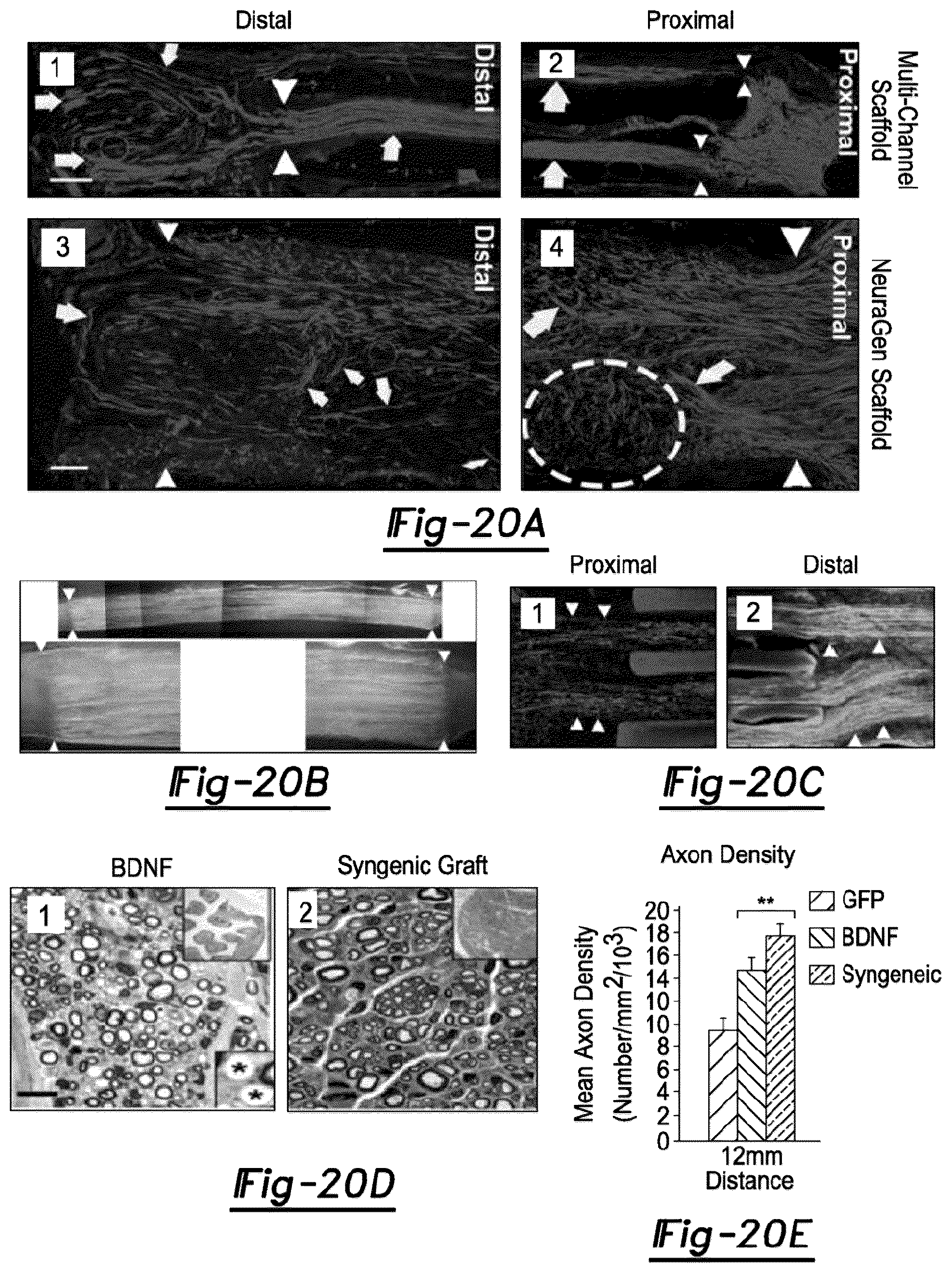 Patent US12377195 Figure 14 – Nerve repair scaffolds having high microchannel volume and methods for making the same