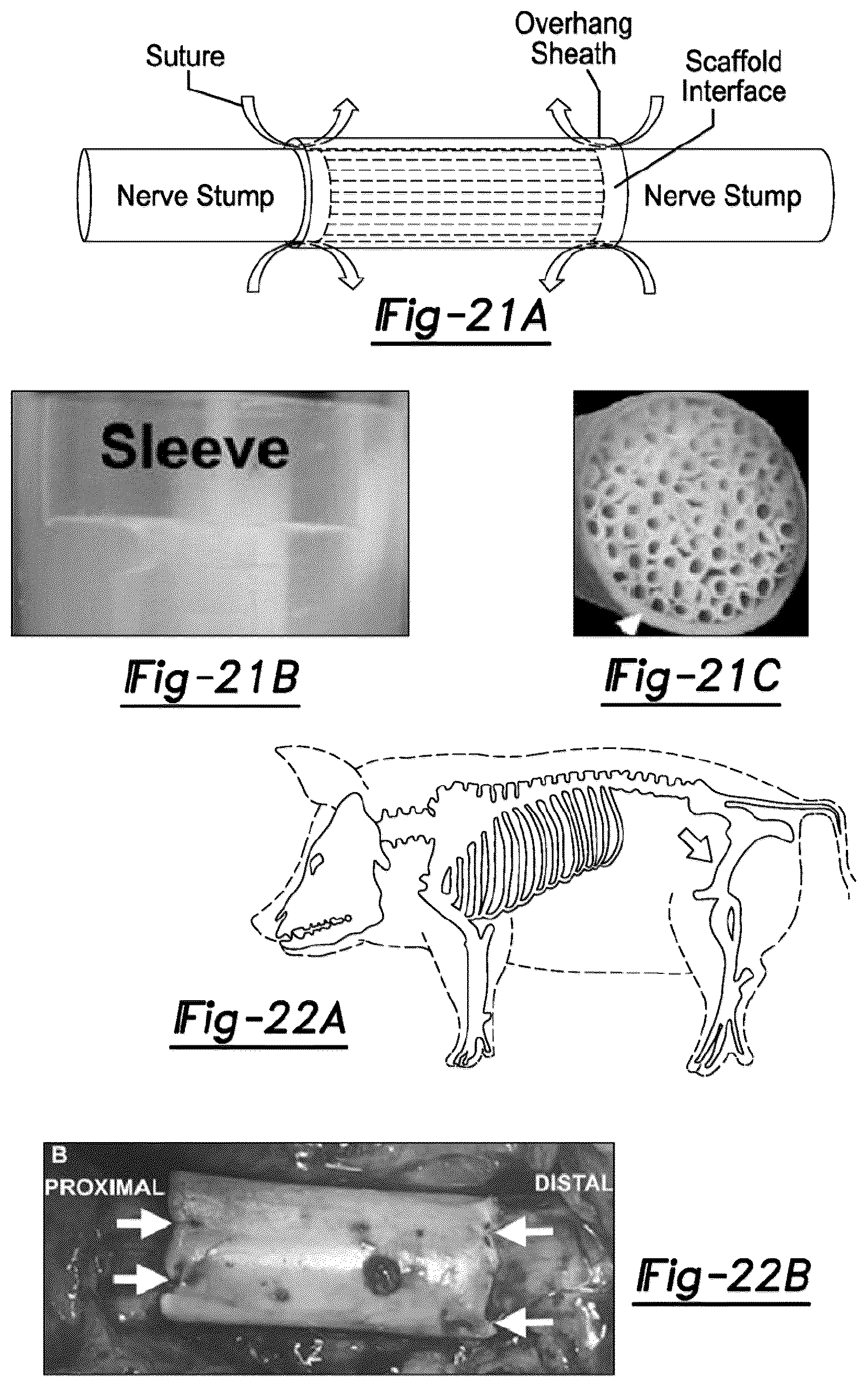 Patent US12377195 Figure 15 – Nerve repair scaffolds having high microchannel volume and methods for making the same