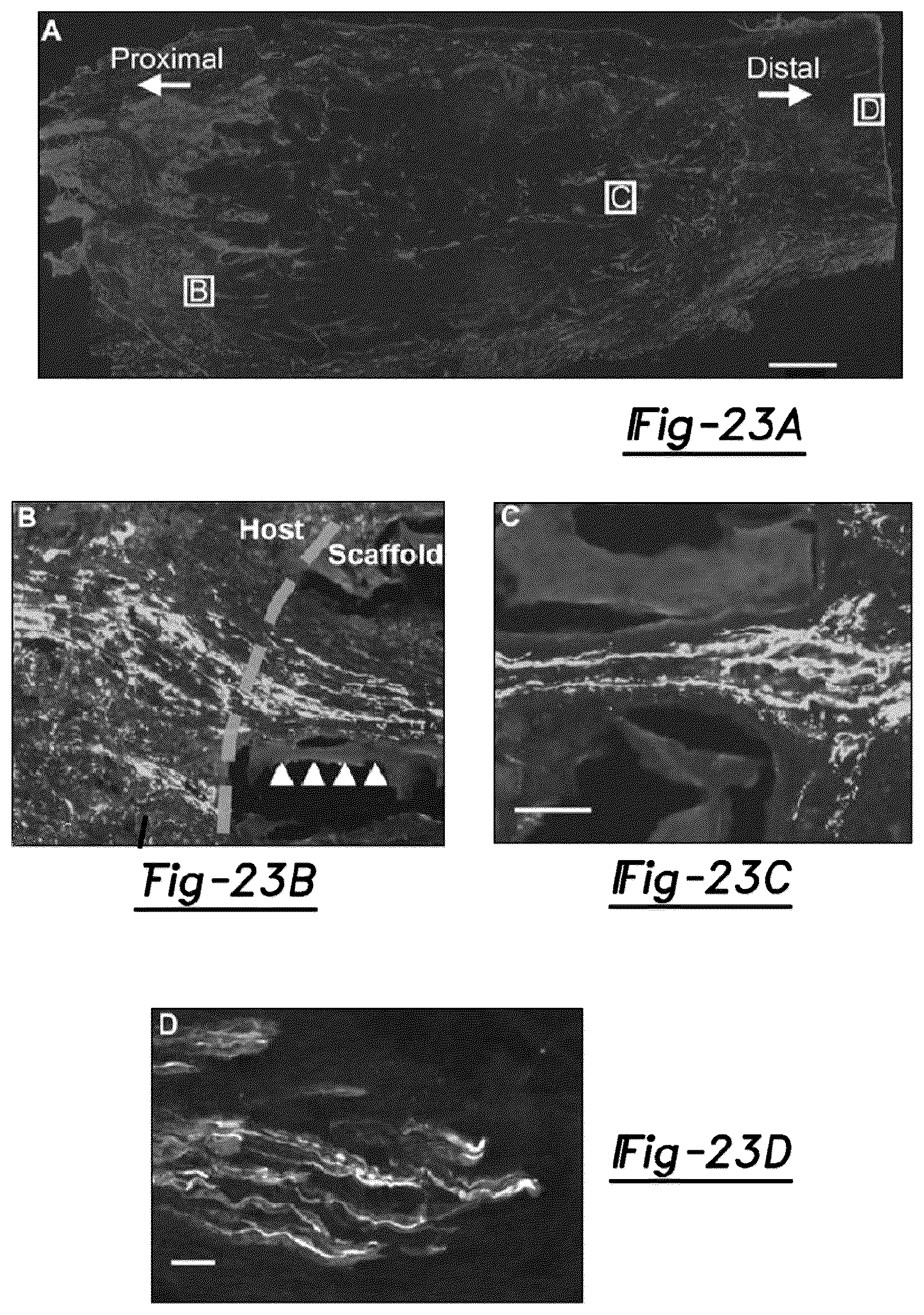 Patent US12377195 Figure 16 – Nerve repair scaffolds having high microchannel volume and methods for making the same