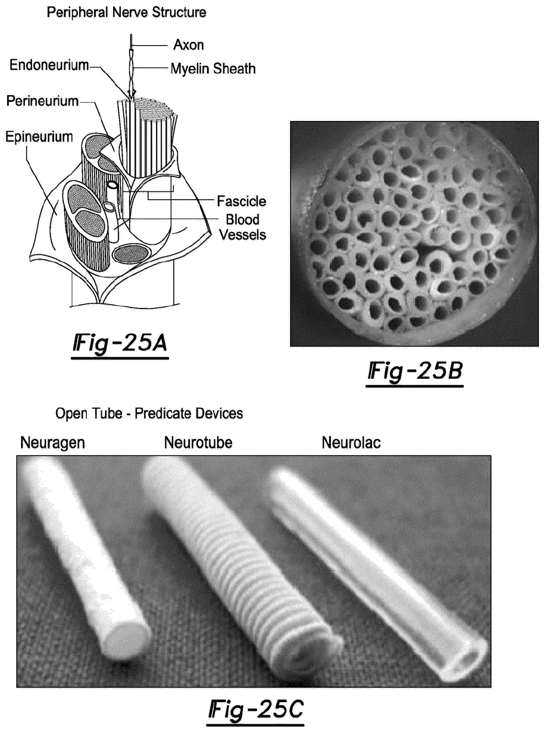Patent US12377195 Figure 18 – Nerve repair scaffolds having high microchannel volume and methods for making the same