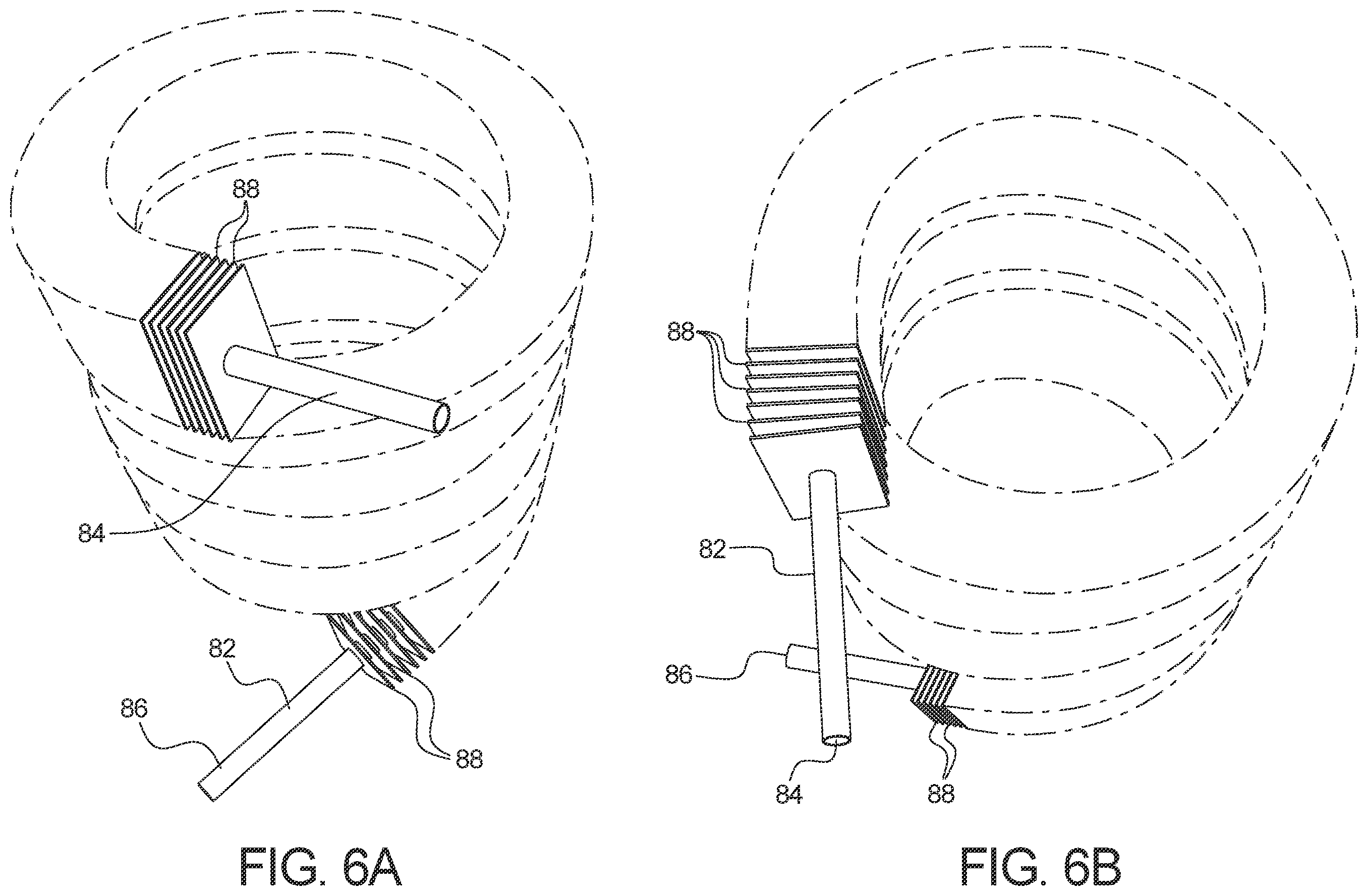 Patent US12377199 Figure 6 – Medical fluid therapy system and method employing distillation