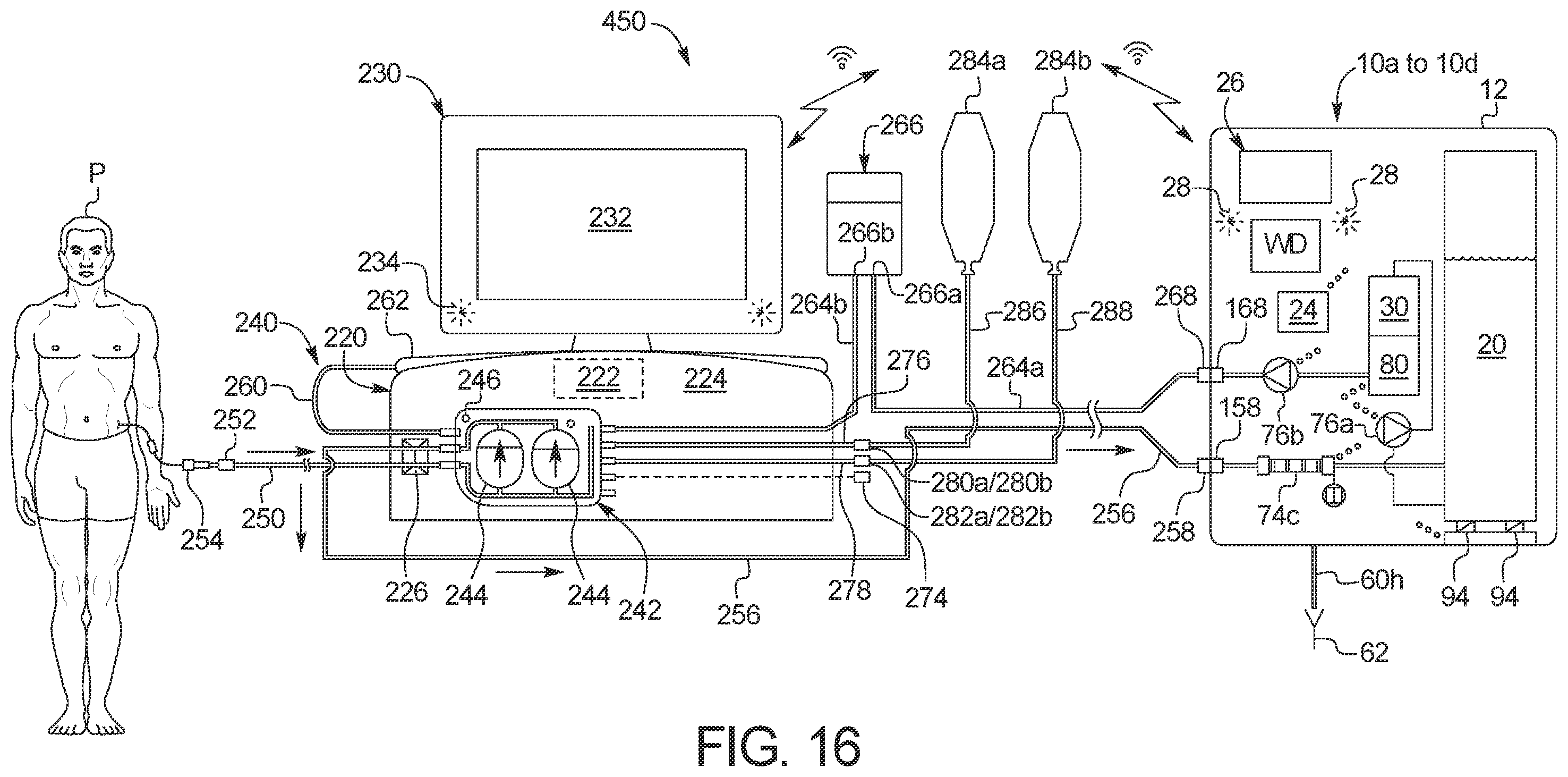Patent US12377199 Figure 17 – Medical fluid therapy system and method employing distillation