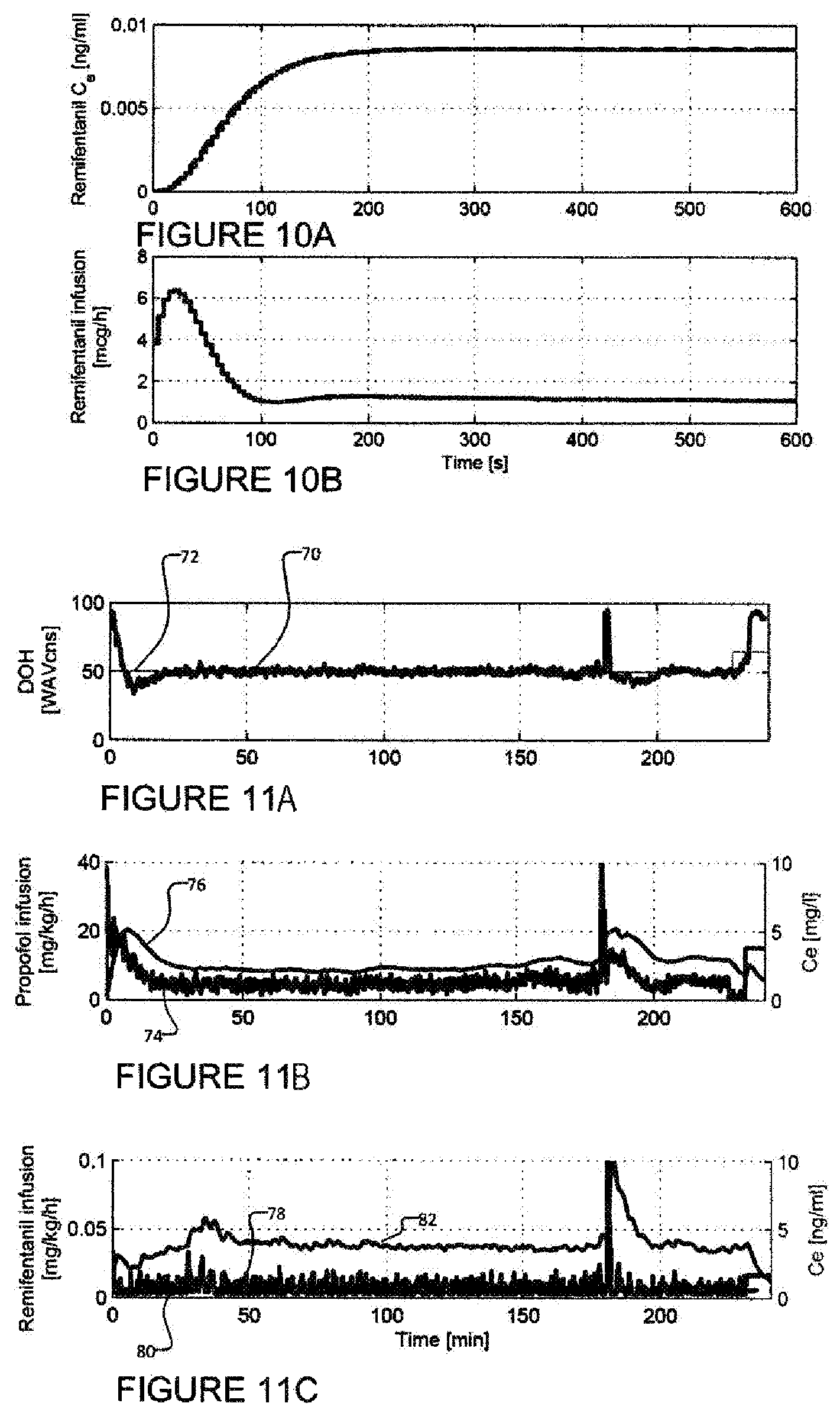 Patent US12377214 Figure 6 – Systems and methods for controlled delivery of analgesic and hypnotic agents