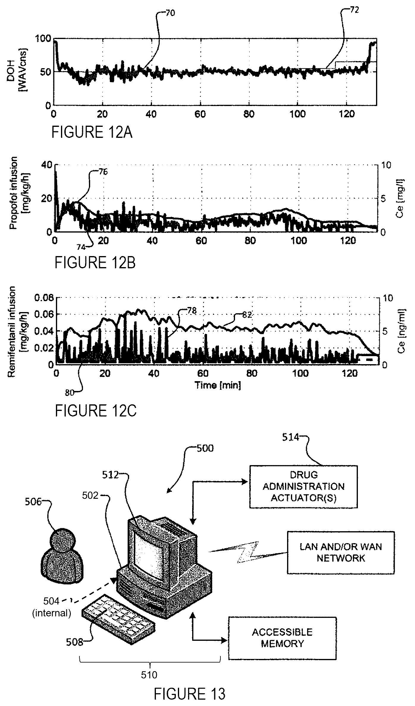 Patent US12377214 Figure 7 – Systems and methods for controlled delivery of analgesic and hypnotic agents