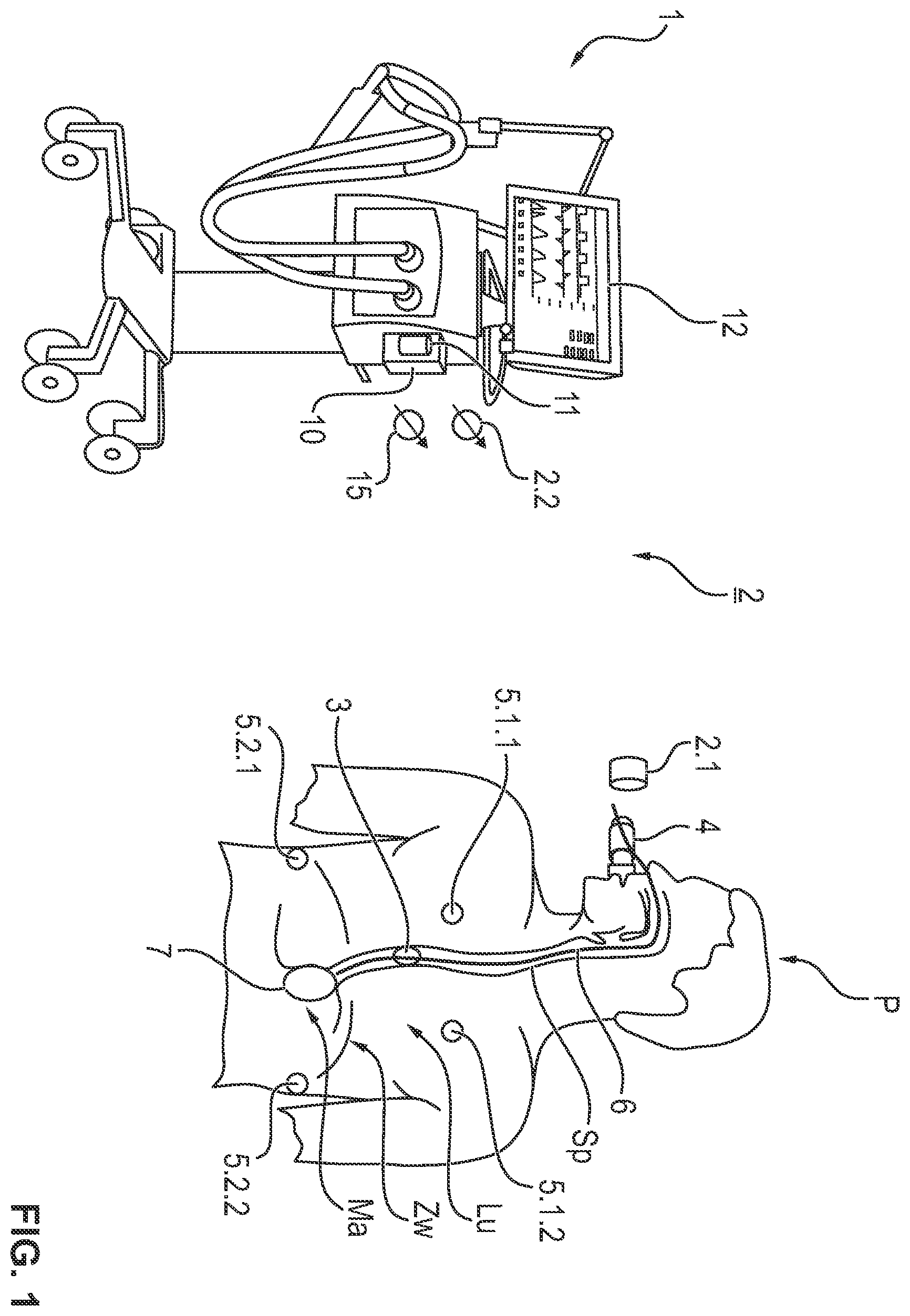 Patent US12377233 Figure 1 – Process and devices for automatically specifying the frequency set point of a ventilator