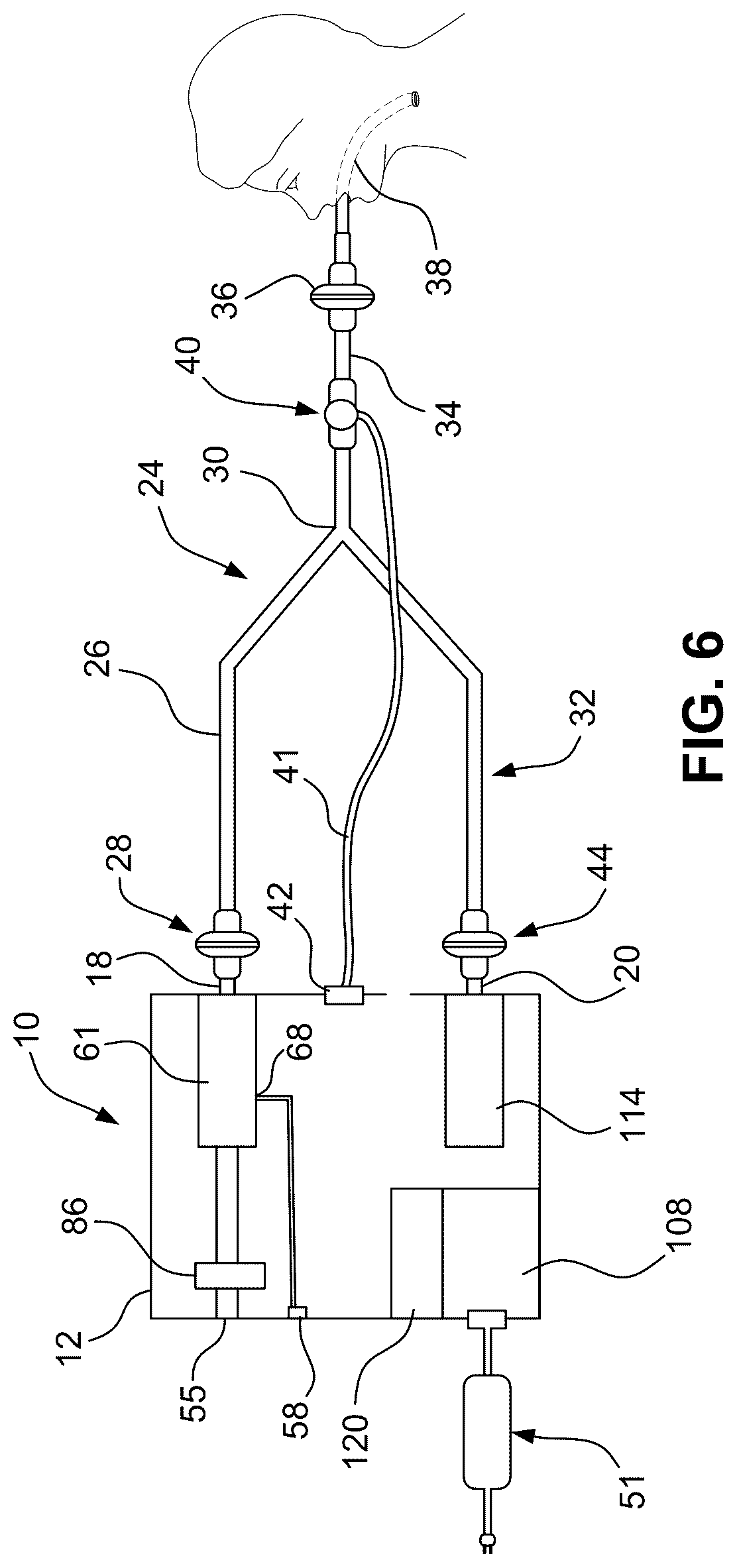 Patent US12377238 Figure 6 – Automated ventilator