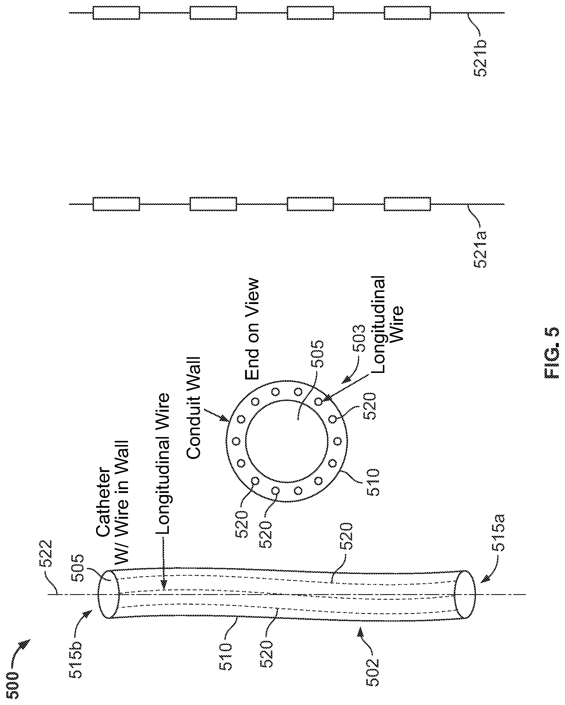 Patent US12377244 Figure 5 – Catheters with expandable and collapsible lumens