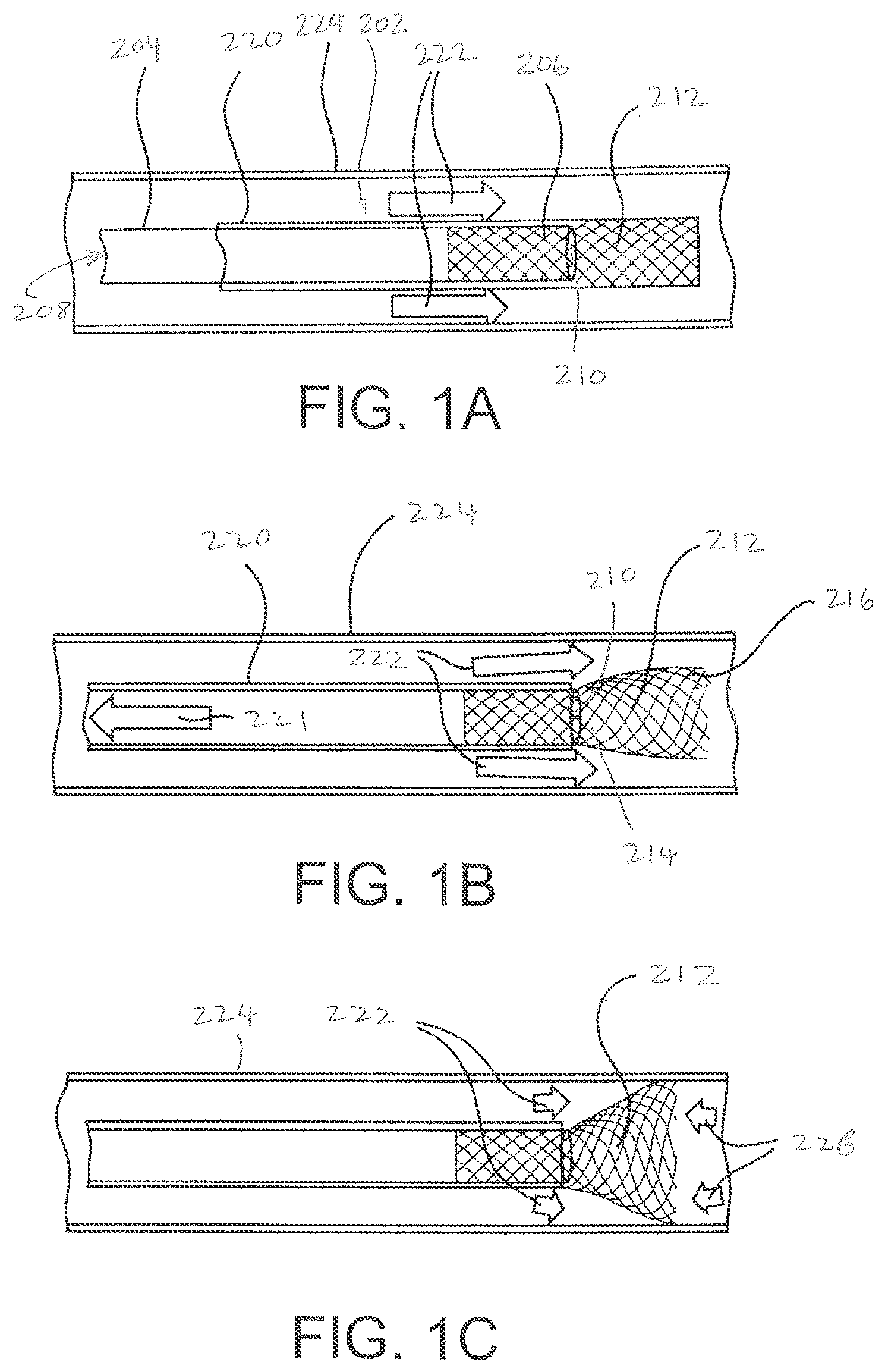 Patent US12377245 Figure 1 – Method of delivering a therapeutic agent to a solid tumor for treatment