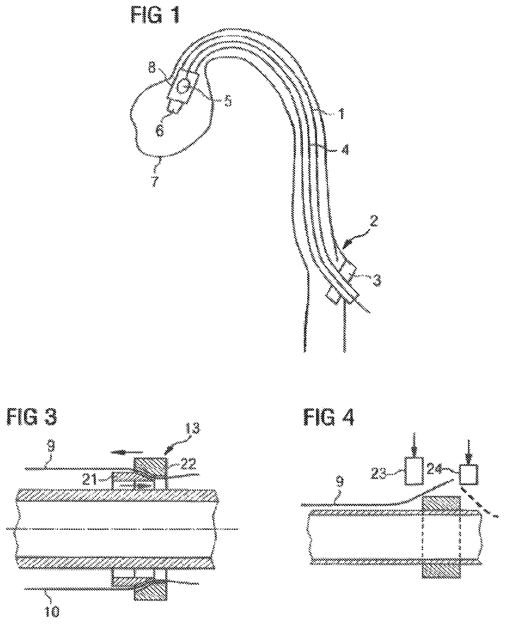 Patent US12377246 Figure 1 – Catheter device having a catheter and an actuation device