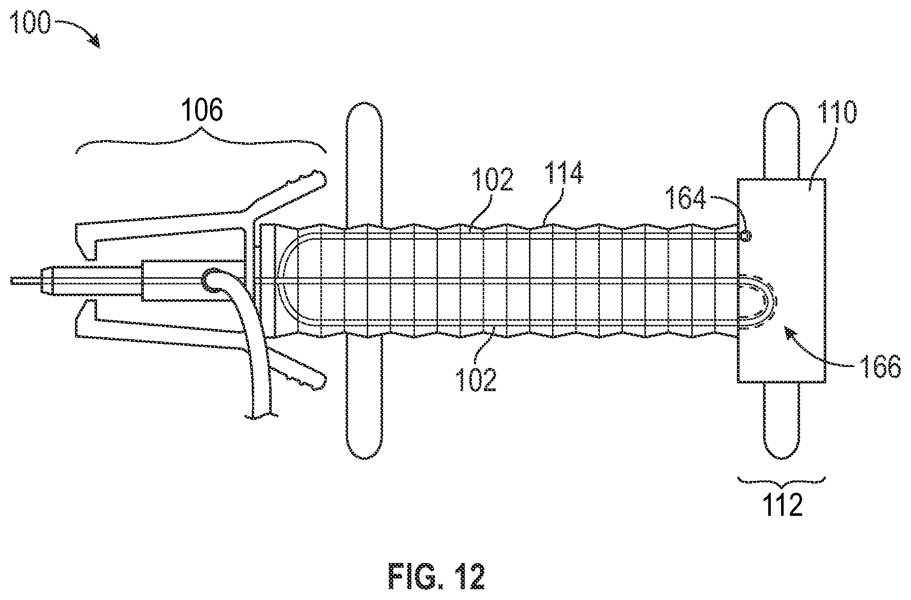 Patent US12377248 Figure 14 – Vascular access device assembly facilitating single-handed probe advancement with a support member