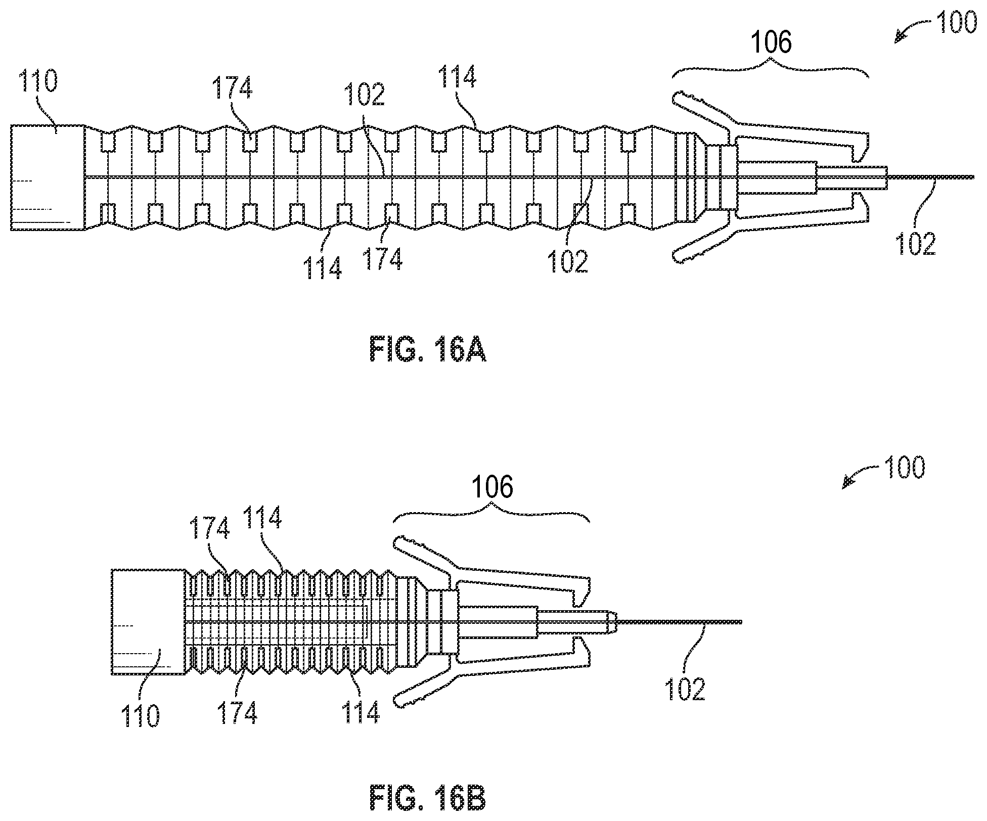 Patent US12377248 Figure 18 – Vascular access device assembly facilitating single-handed probe advancement with a support member