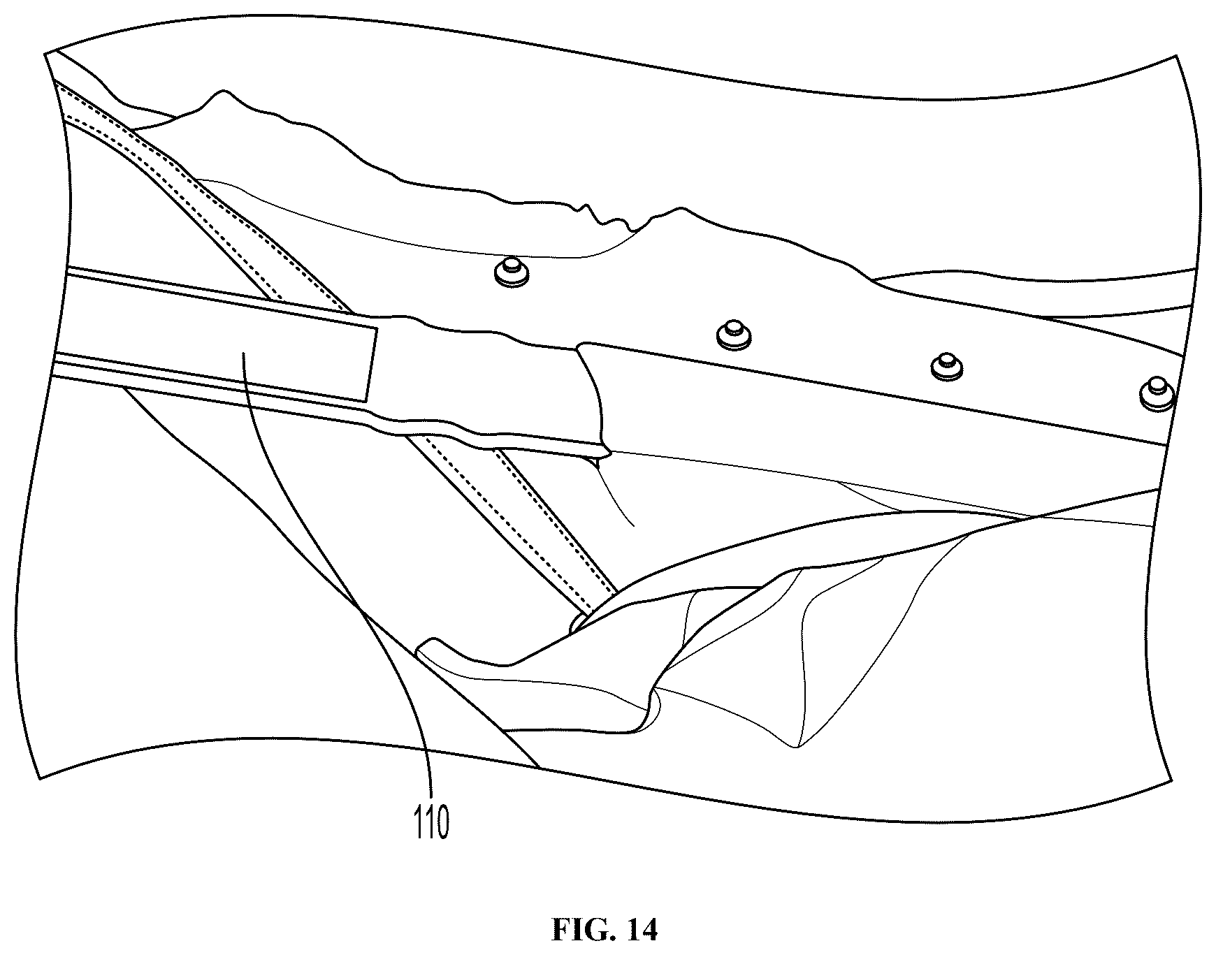 Patent US12377252 Figure 14 – Implantation devices, system, and methods