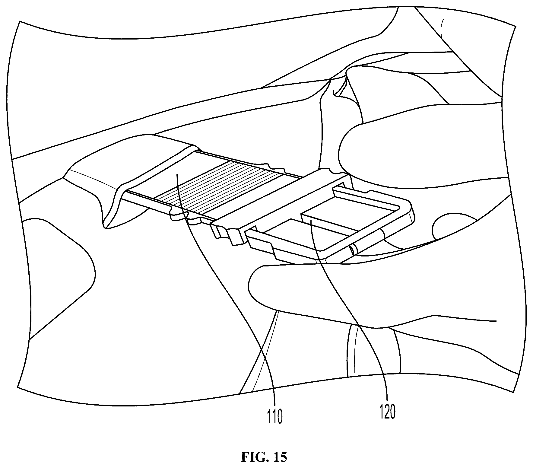 Patent US12377252 Figure 15 – Implantation devices, system, and methods