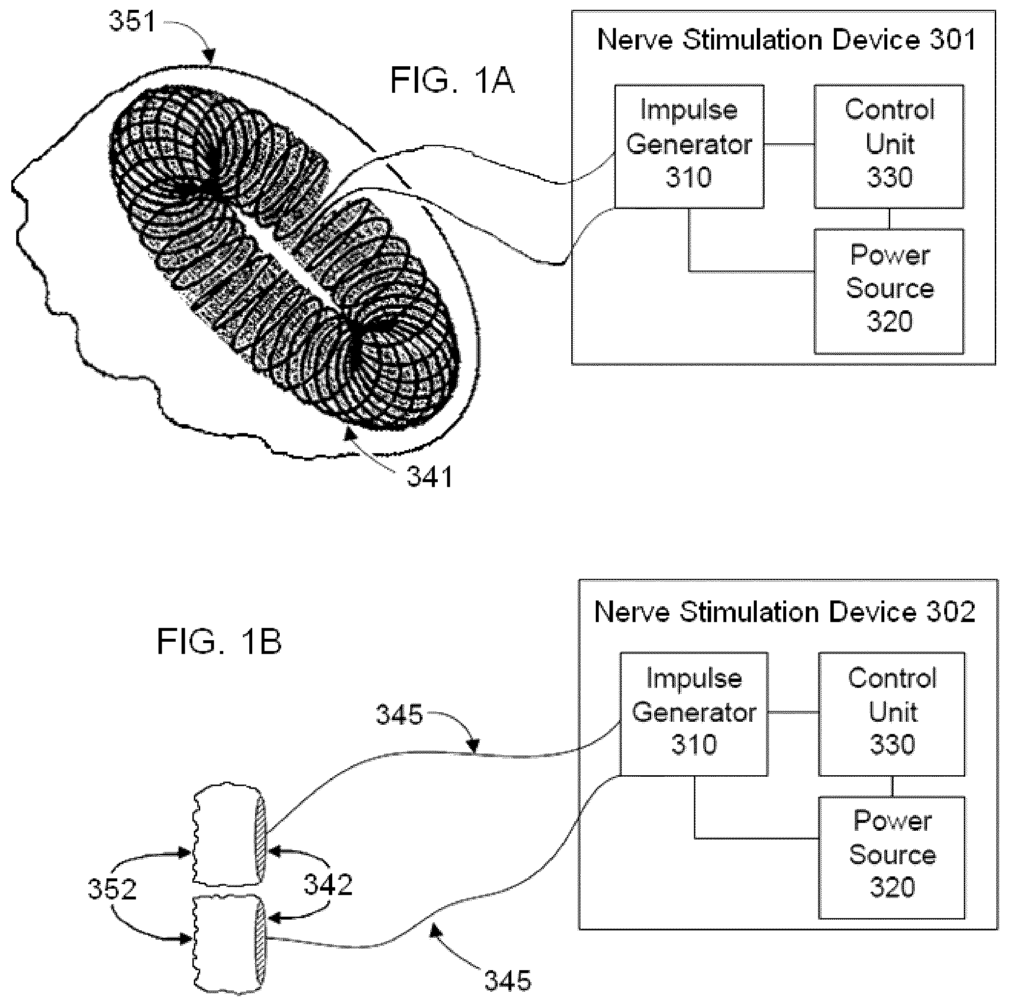 Patent US12377260 — Vagal nerve stimulation — Figure 1
