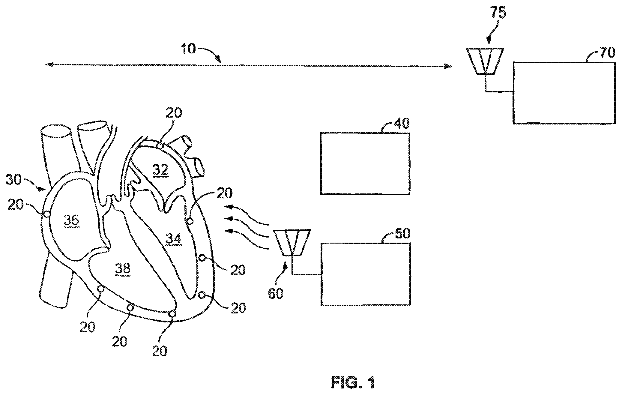 Patent US12377263 Figure 1 – Leadless cardiac stimulation systems