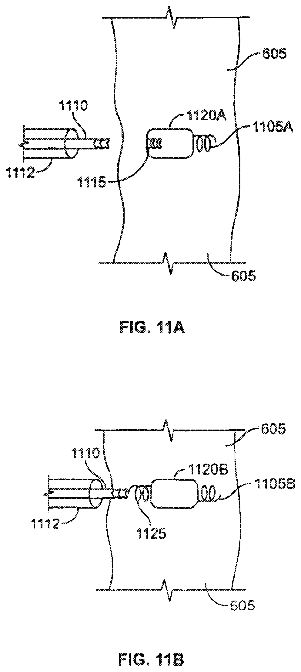 Patent US12377263 Figure 10 – Leadless cardiac stimulation systems