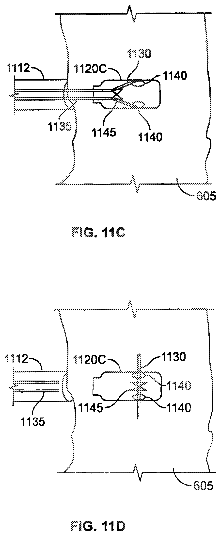 Patent US12377263 Figure 11 – Leadless cardiac stimulation systems