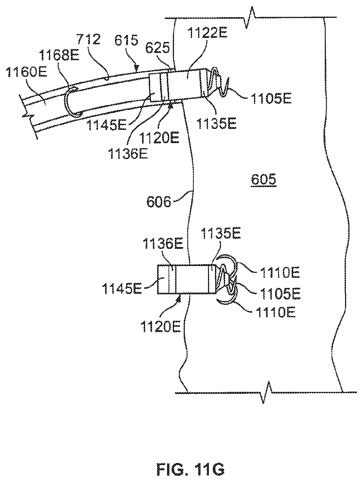 Patent US12377263 Figure 13 – Leadless cardiac stimulation systems
