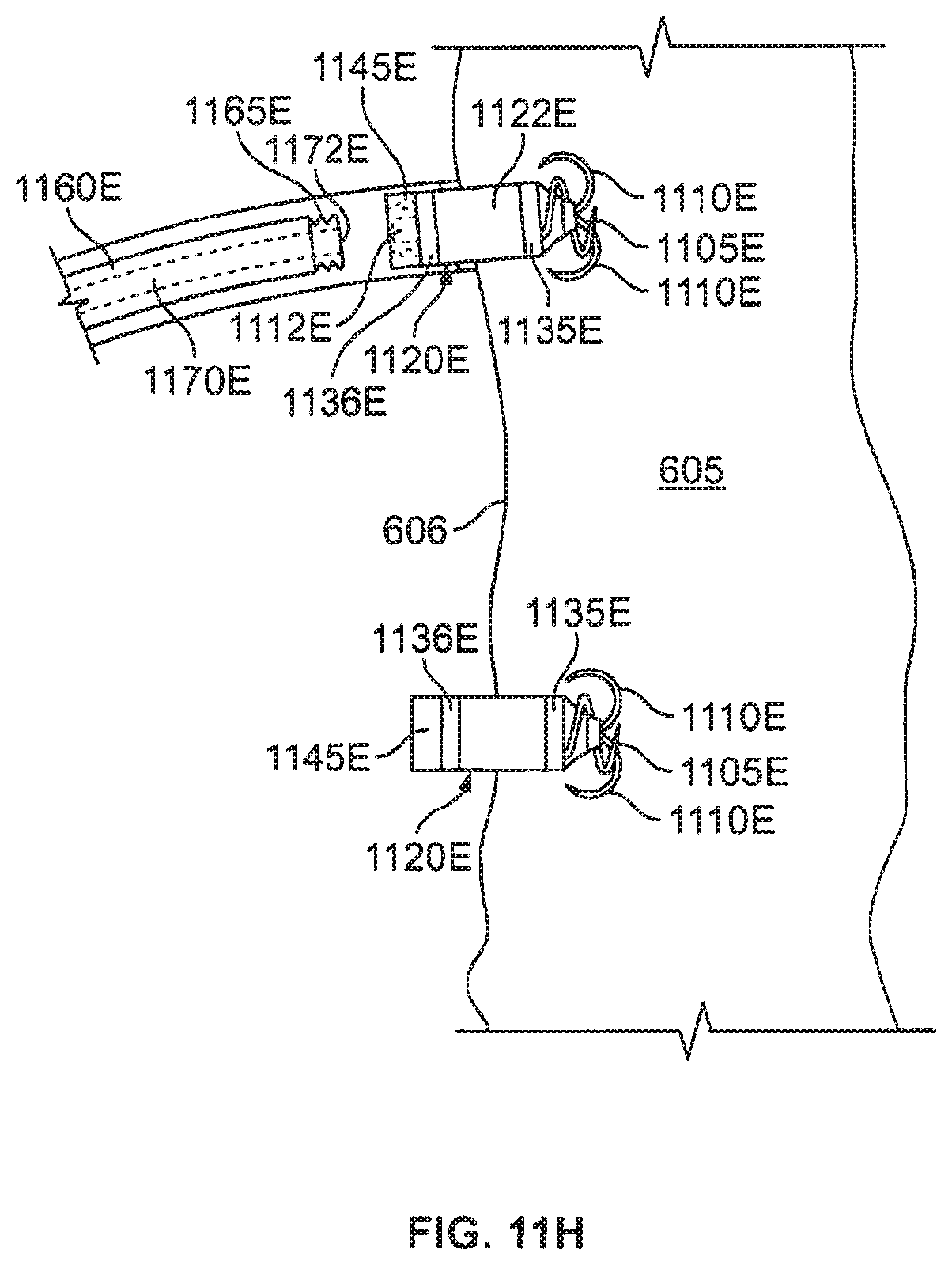 Patent US12377263 Figure 14 – Leadless cardiac stimulation systems
