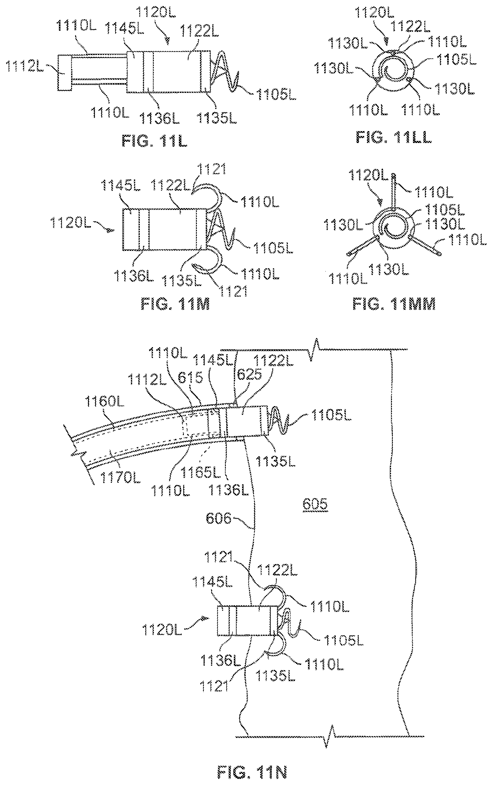 Patent US12377263 Figure 16 – Leadless cardiac stimulation systems