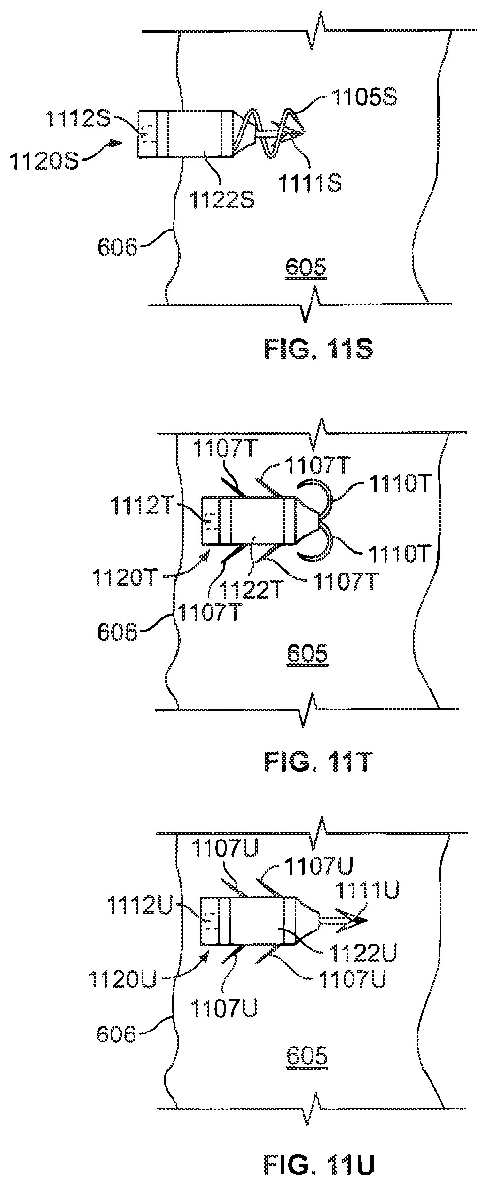 Patent US12377263 Figure 18 – Leadless cardiac stimulation systems