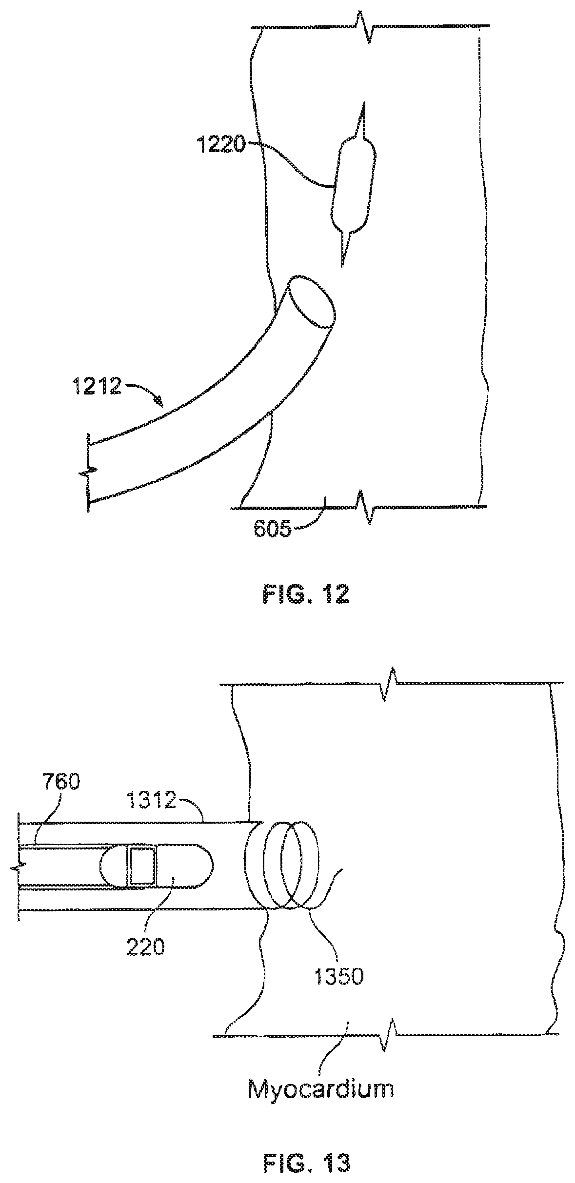 Patent US12377263 Figure 20 – Leadless cardiac stimulation systems