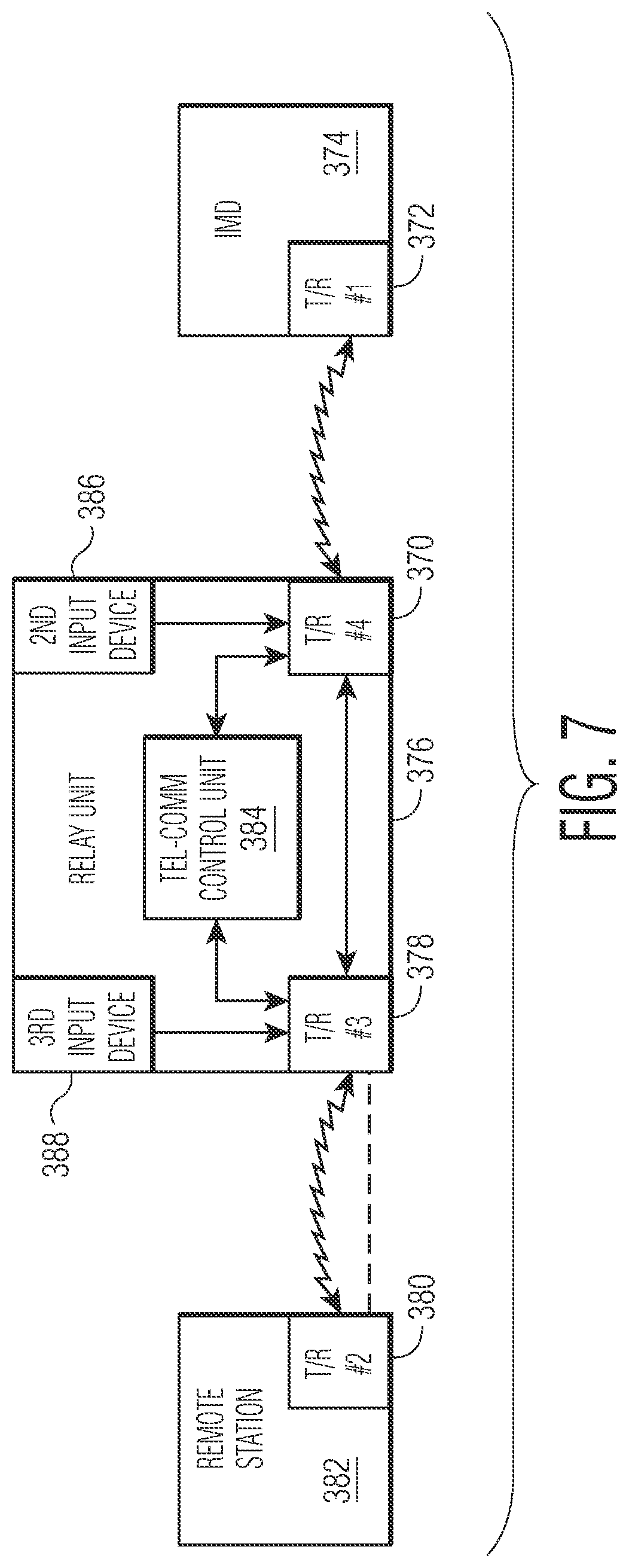 Patent US12377264 Figure 16 – Implantable medical device which may be controlled from central station