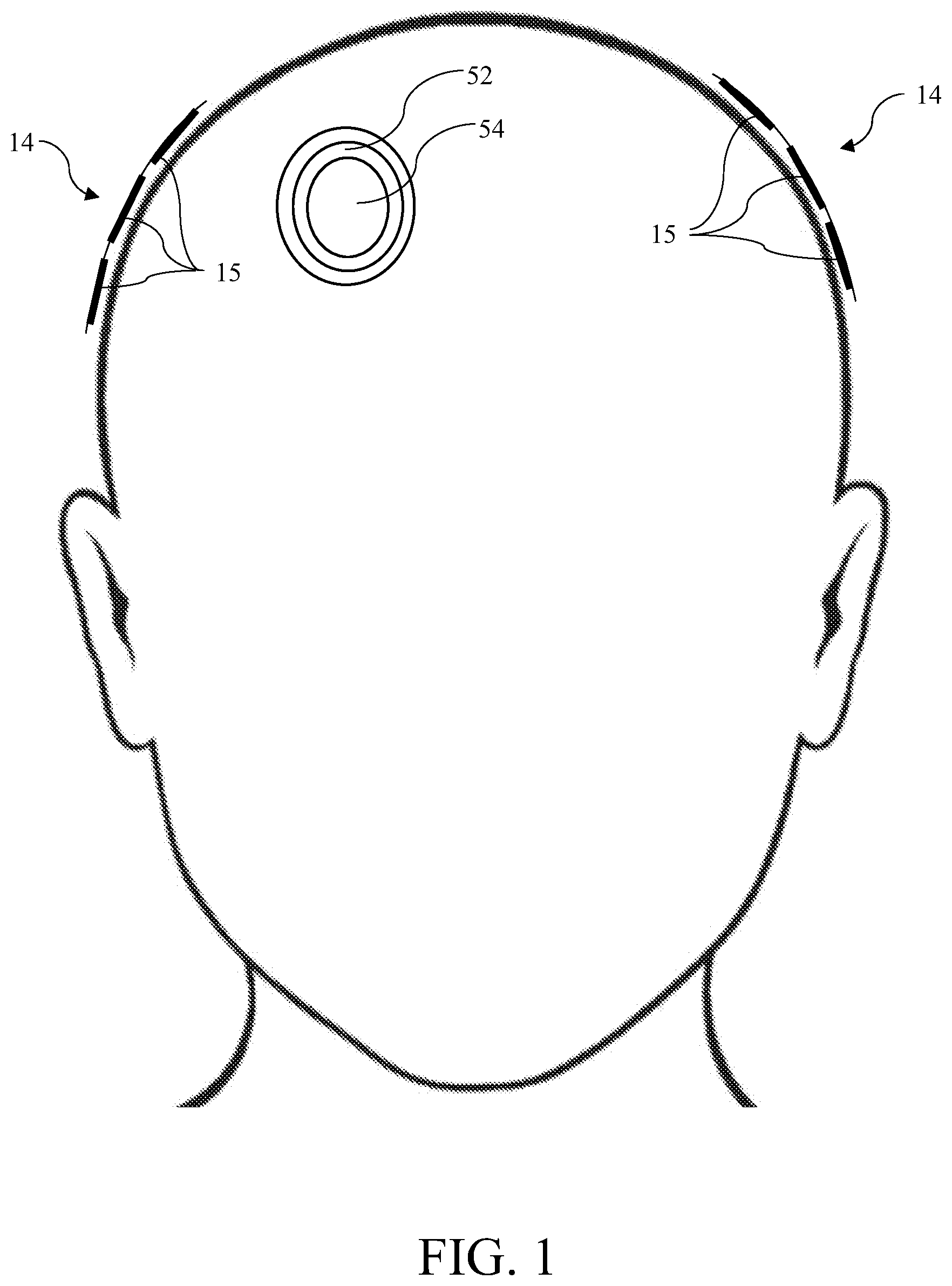 Patent US12377265 — Nonconductive field guide for resection cavity, and systems and methods of using same — Figure 1