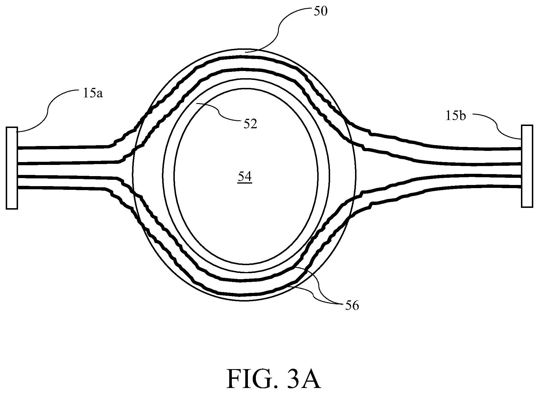 Patent US12377265 Figure 3 – Nonconductive field guide for resection cavity, and systems and methods of using same