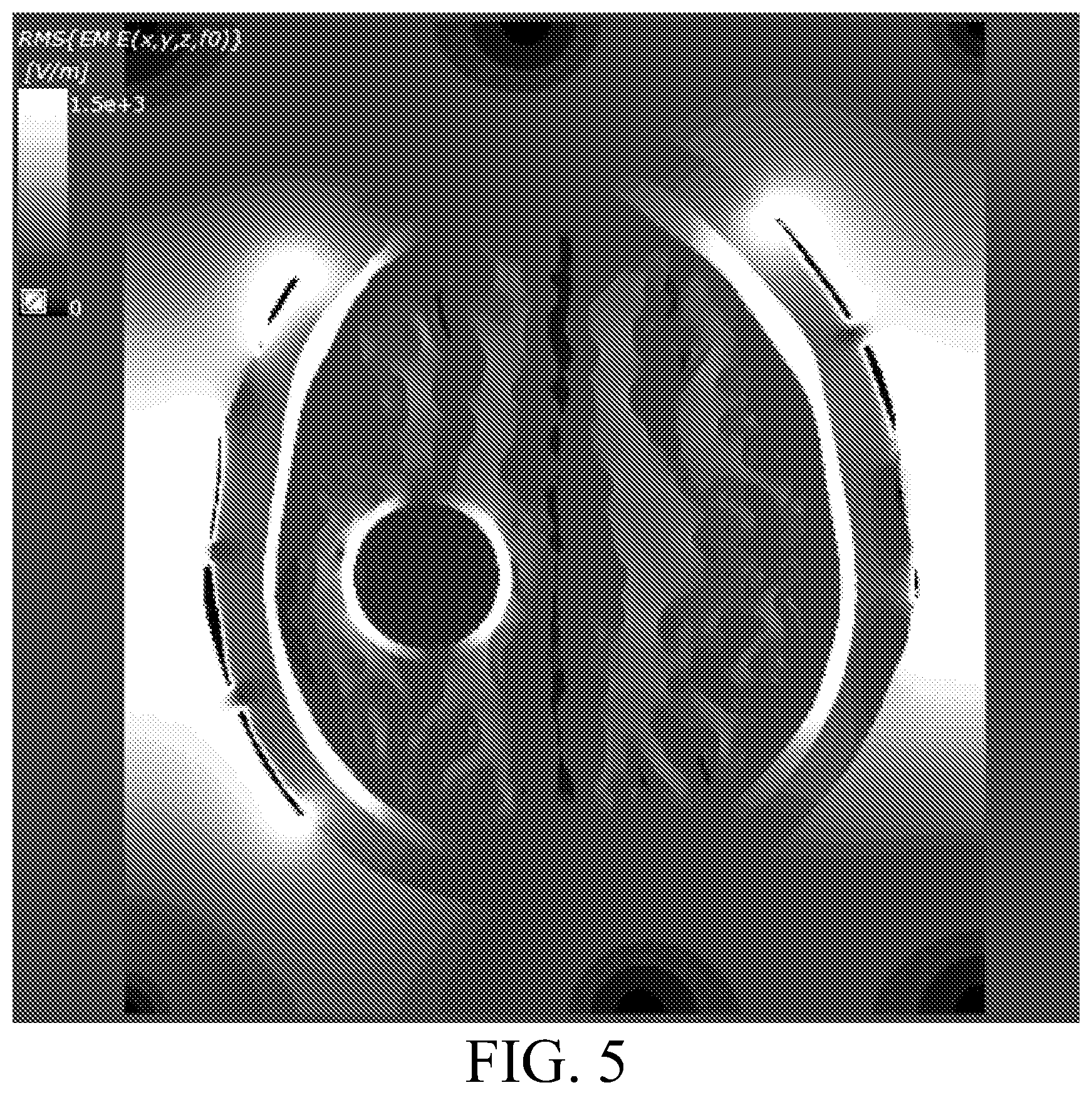 Patent US12377265 Figure 6 – Nonconductive field guide for resection cavity, and systems and methods of using same