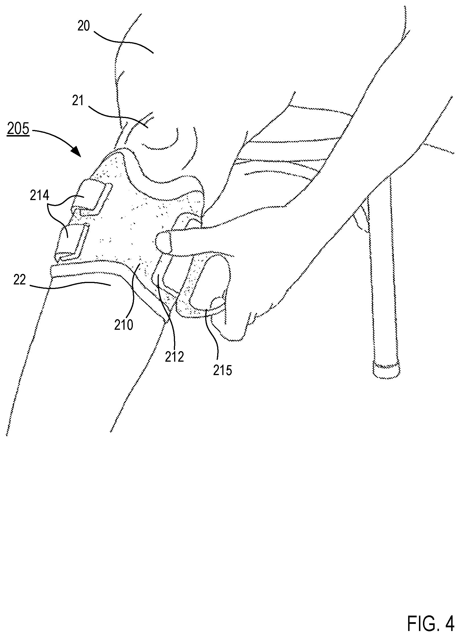Patent US12377266 Figure 4 – Systems and apparatus for gait modulation and methods of use