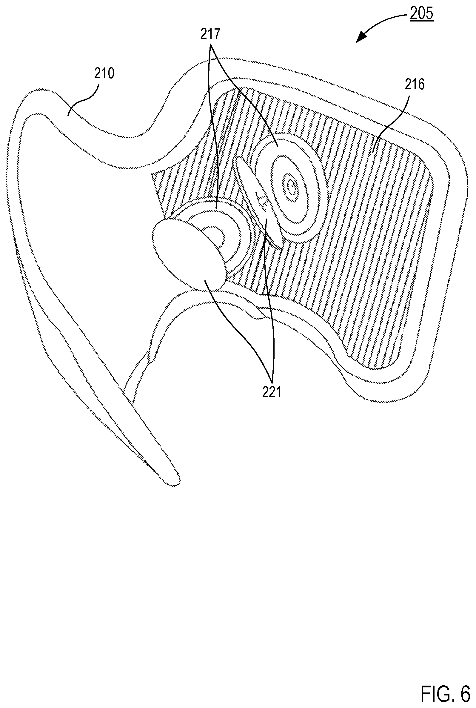 Patent US12377266 Figure 6 – Systems and apparatus for gait modulation and methods of use