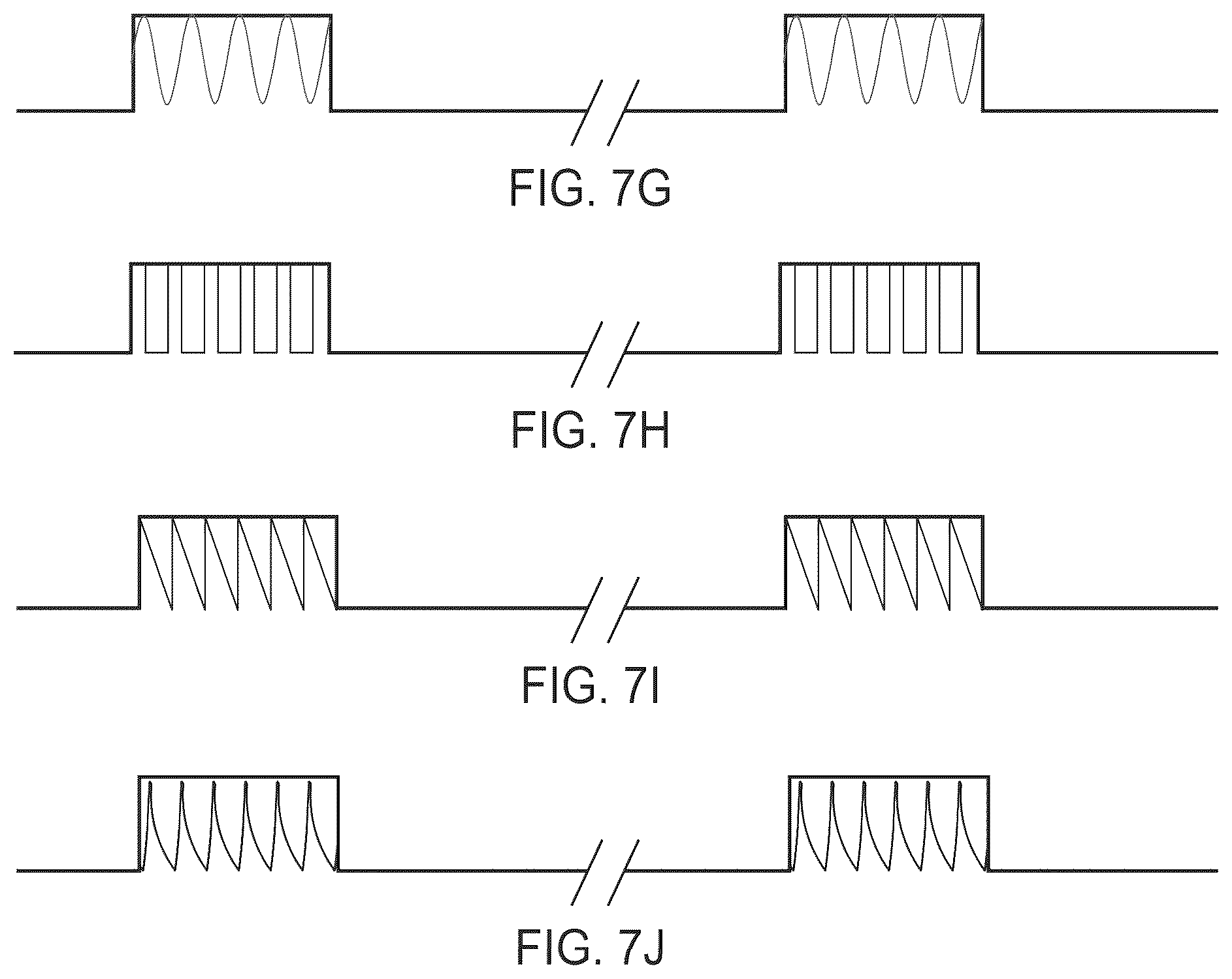 Patent US12377272 Figure 12 – Device and method to selectively and reversibly modulate a nervous system structure to inhibit pain