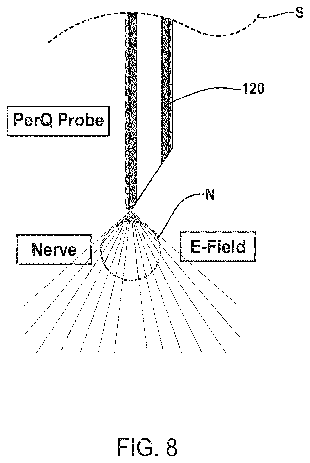 Patent US12377272 Figure 15 – Device and method to selectively and reversibly modulate a nervous system structure to inhibit pain