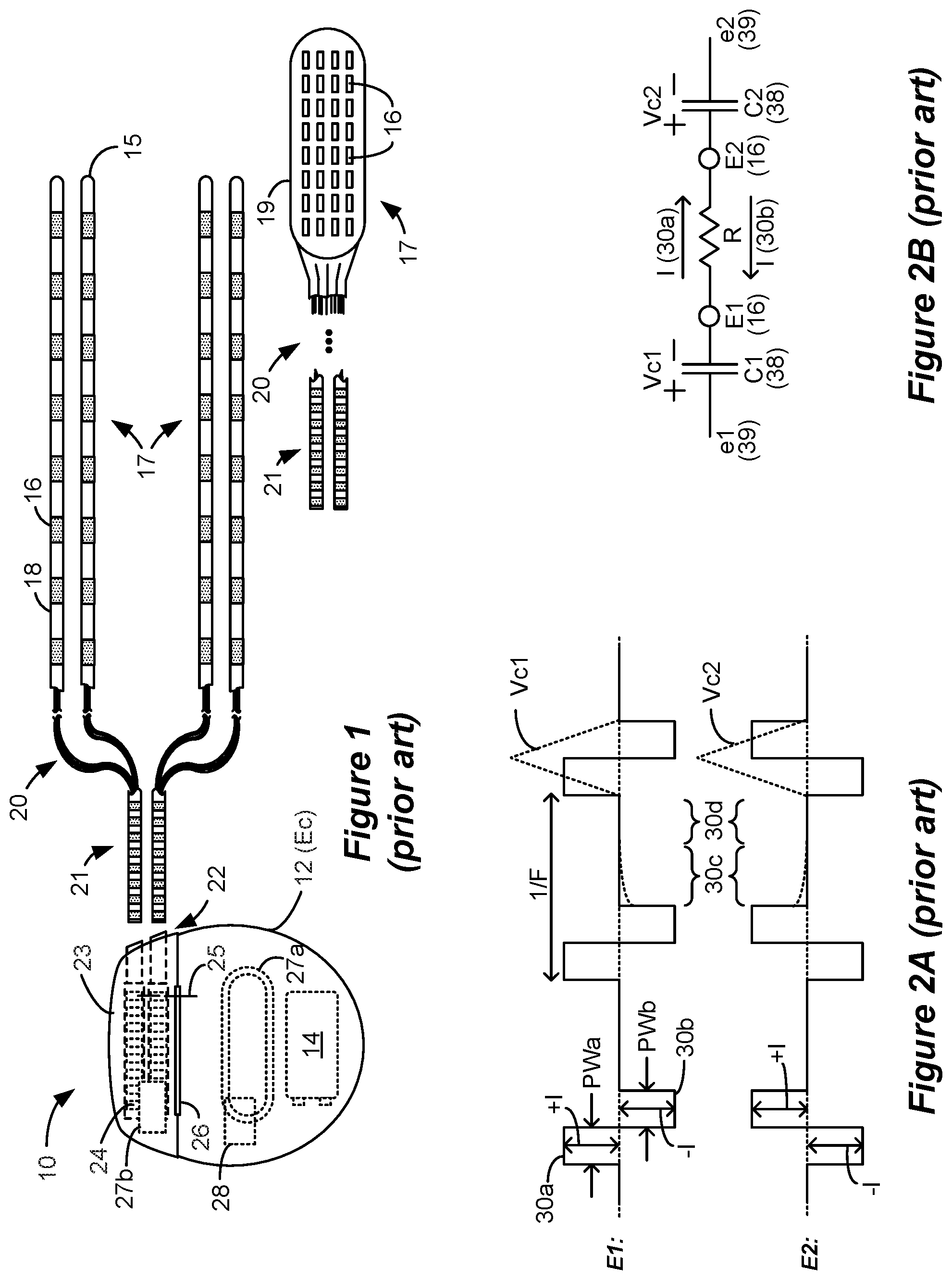 Patent US12377273 Figure 1 – Circuitry to assist with neural sensing in an implantable stimulator device in the presence of stimulation artifacts
