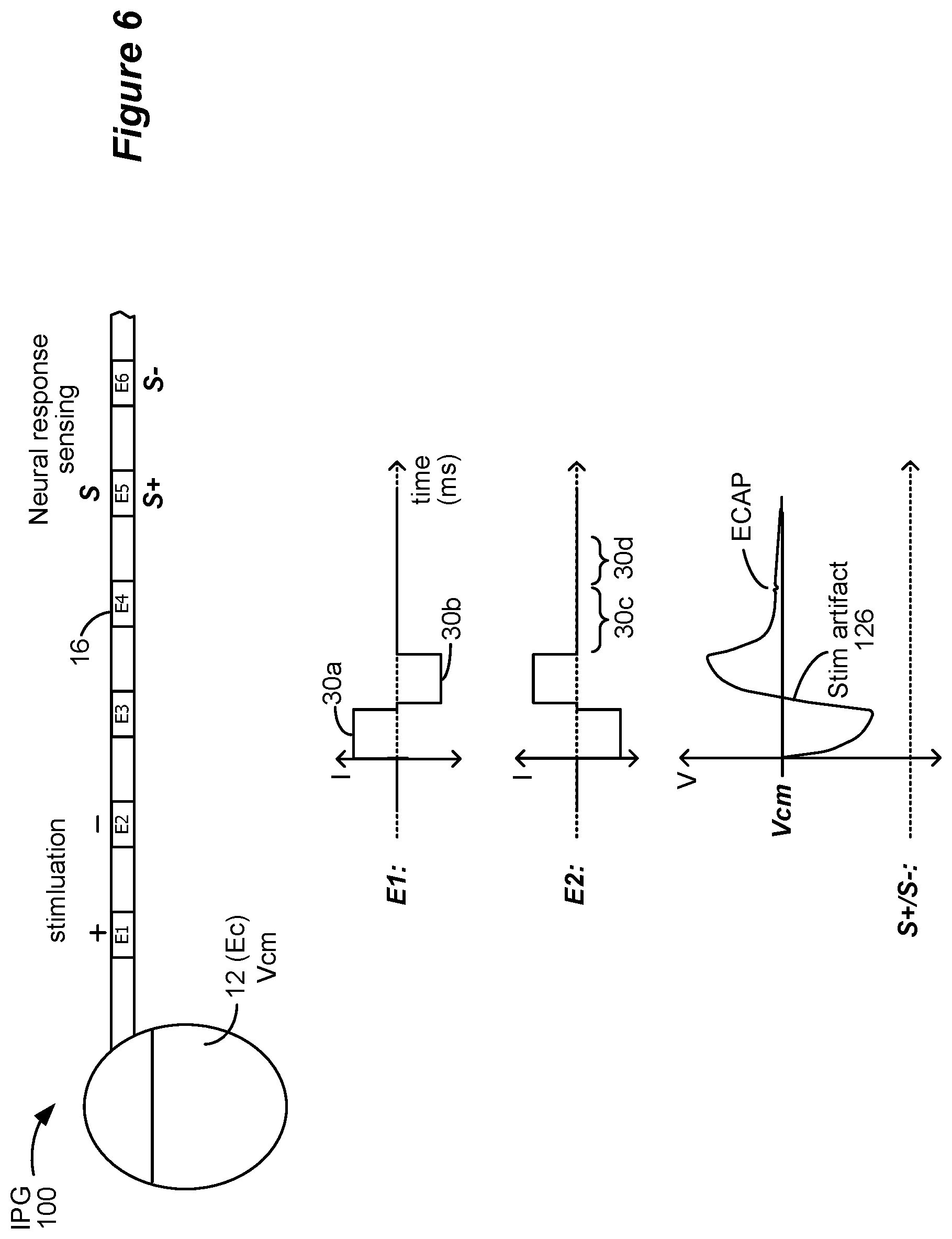 Patent US12377273 Figure 5 – Circuitry to assist with neural sensing in an implantable stimulator device in the presence of stimulation artifacts