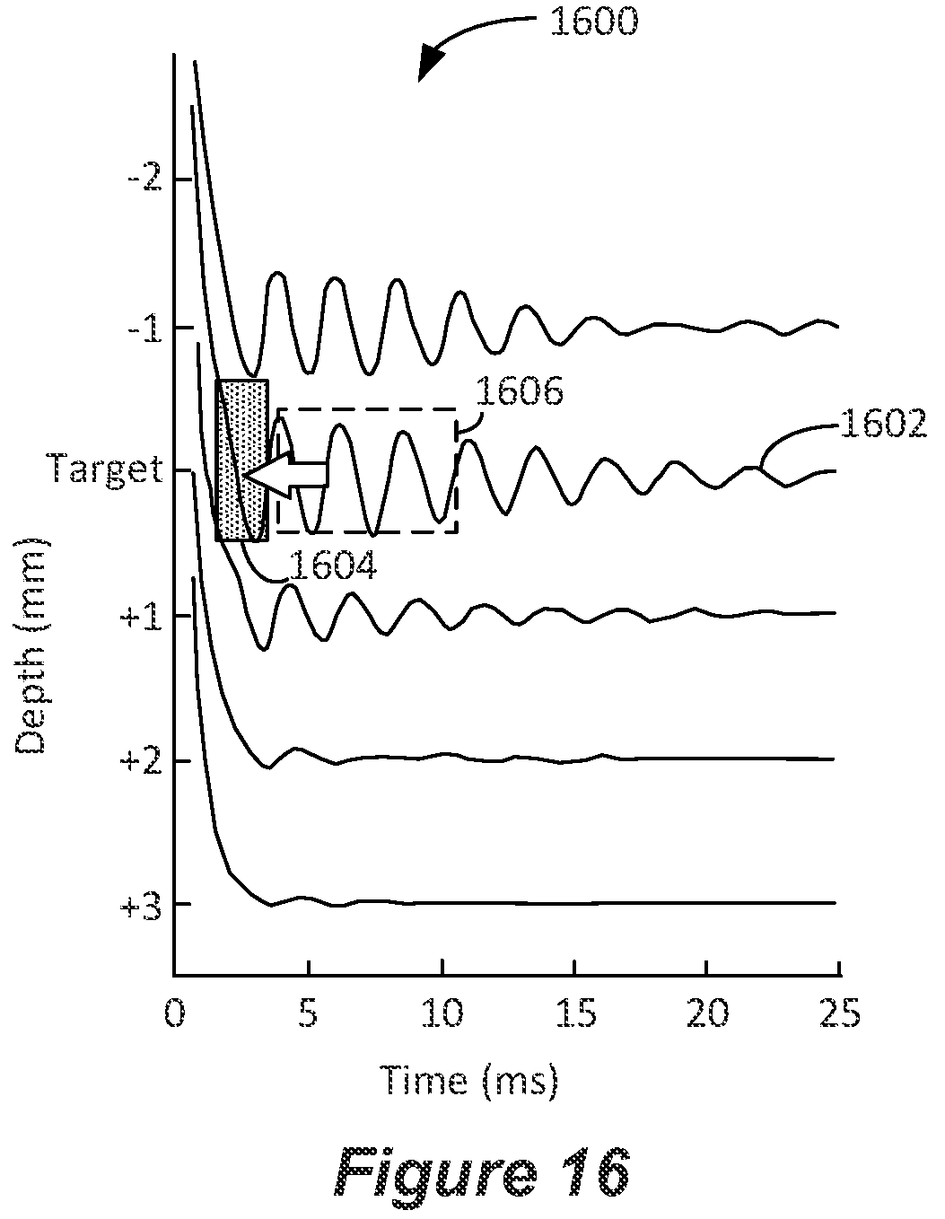 Patent US12377274 Figure 11 – Interpolation methods for neural responses