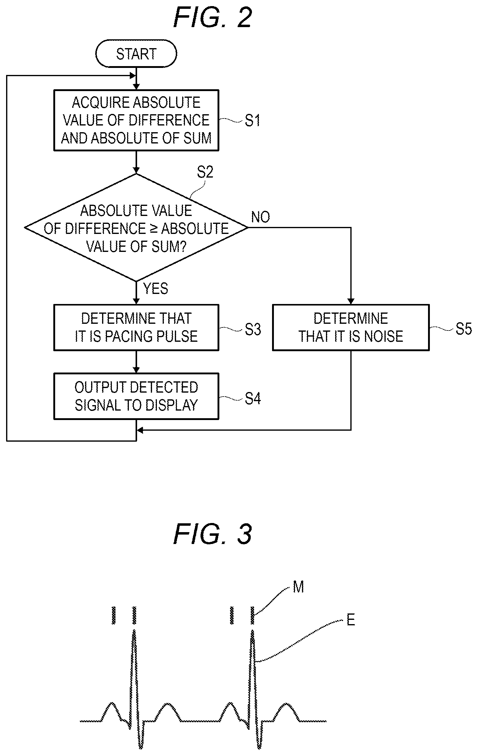 Patent US12377276 Figure 2 – Pulse discrimination device and electrocardiogram analyzer