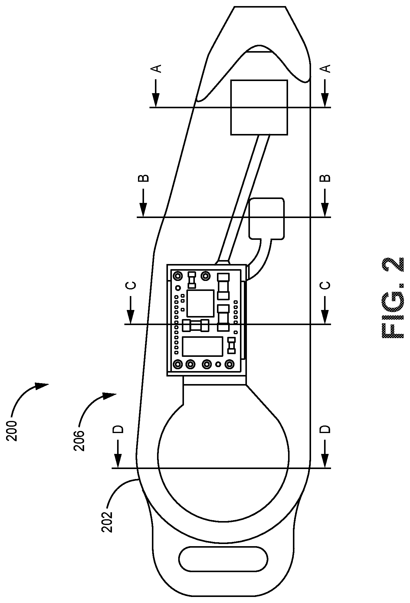 Patent US12377278 Figure 2 – Polymeric enclosure for implantable medical device