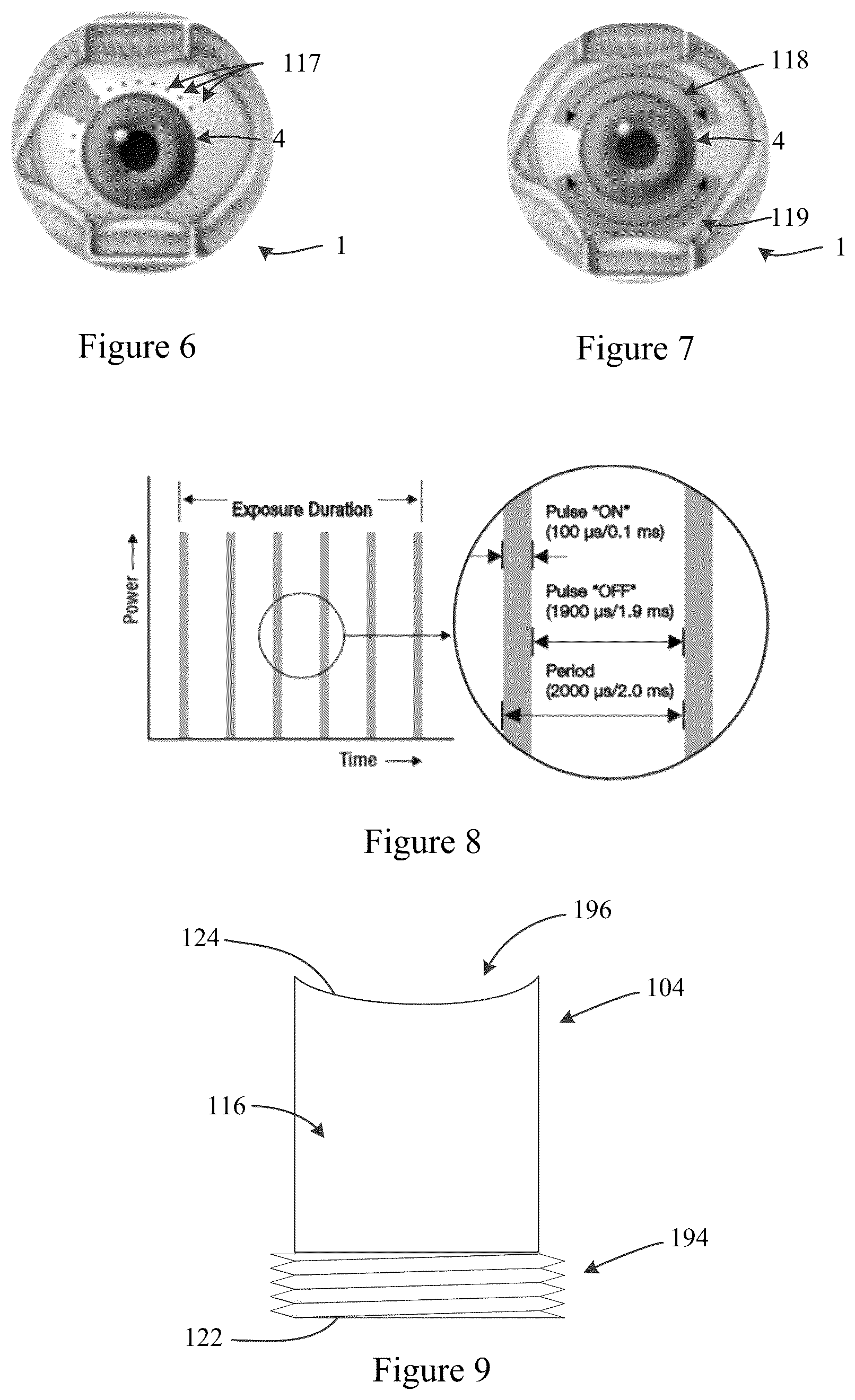 Patent US12377285 Figure 4 – Method and apparatus for cyclo-scanner using surface emitting lasers or LEDs