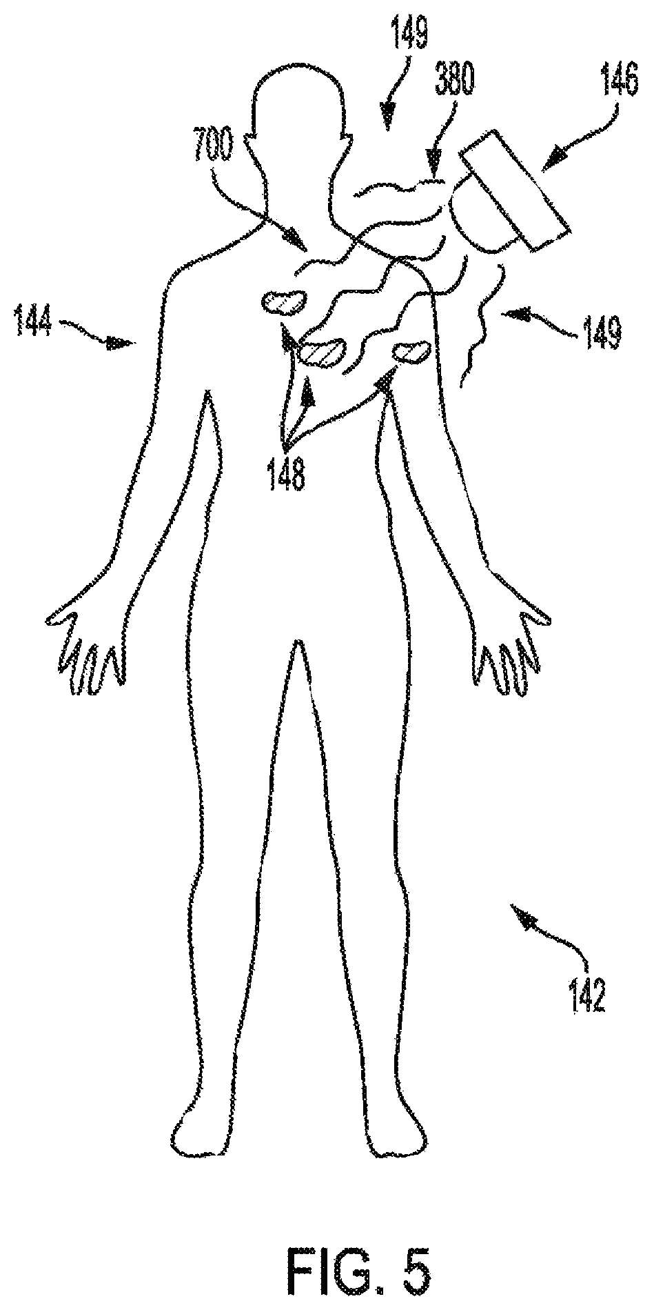 Patent US12377286 Figure 5 – Anti-infective and therapeutic electromagnetic emission methods and devices