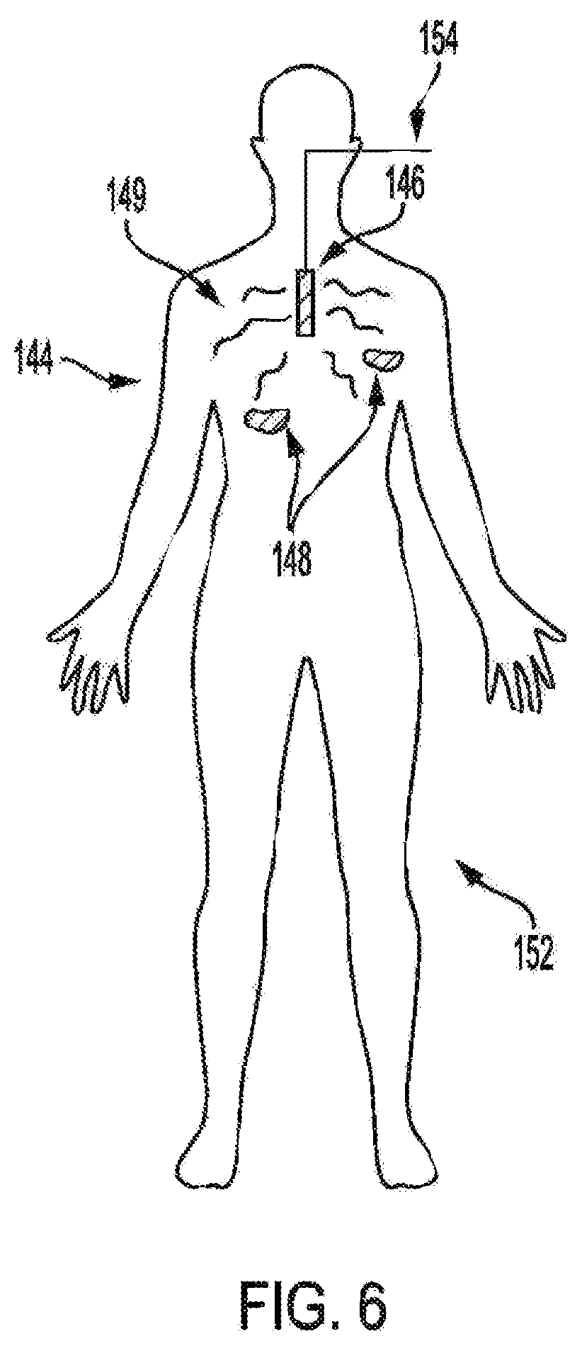 Patent US12377286 Figure 6 – Anti-infective and therapeutic electromagnetic emission methods and devices
