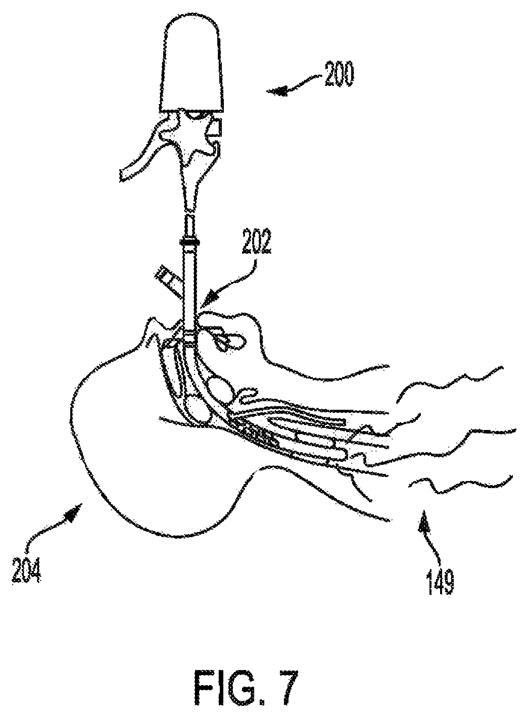 Patent US12377286 Figure 7 – Anti-infective and therapeutic electromagnetic emission methods and devices