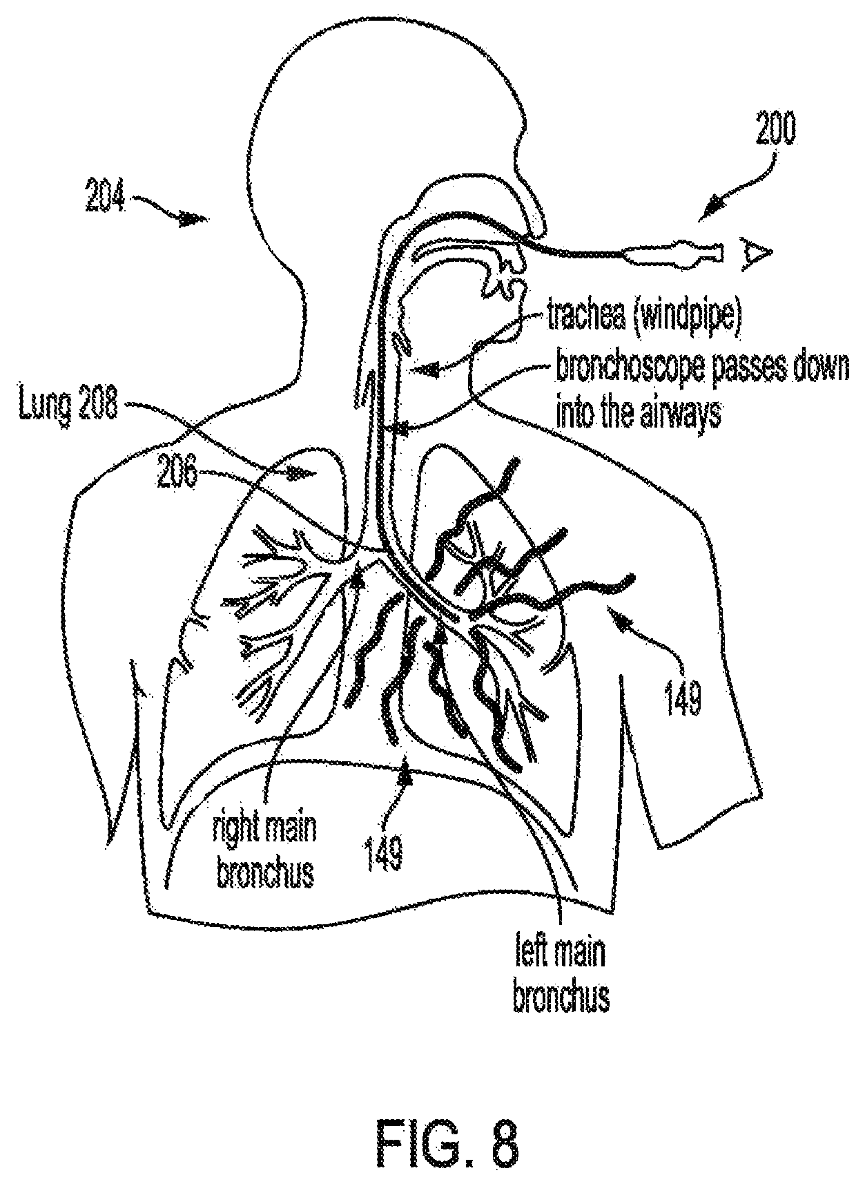 Patent US12377286 Figure 8 – Anti-infective and therapeutic electromagnetic emission methods and devices