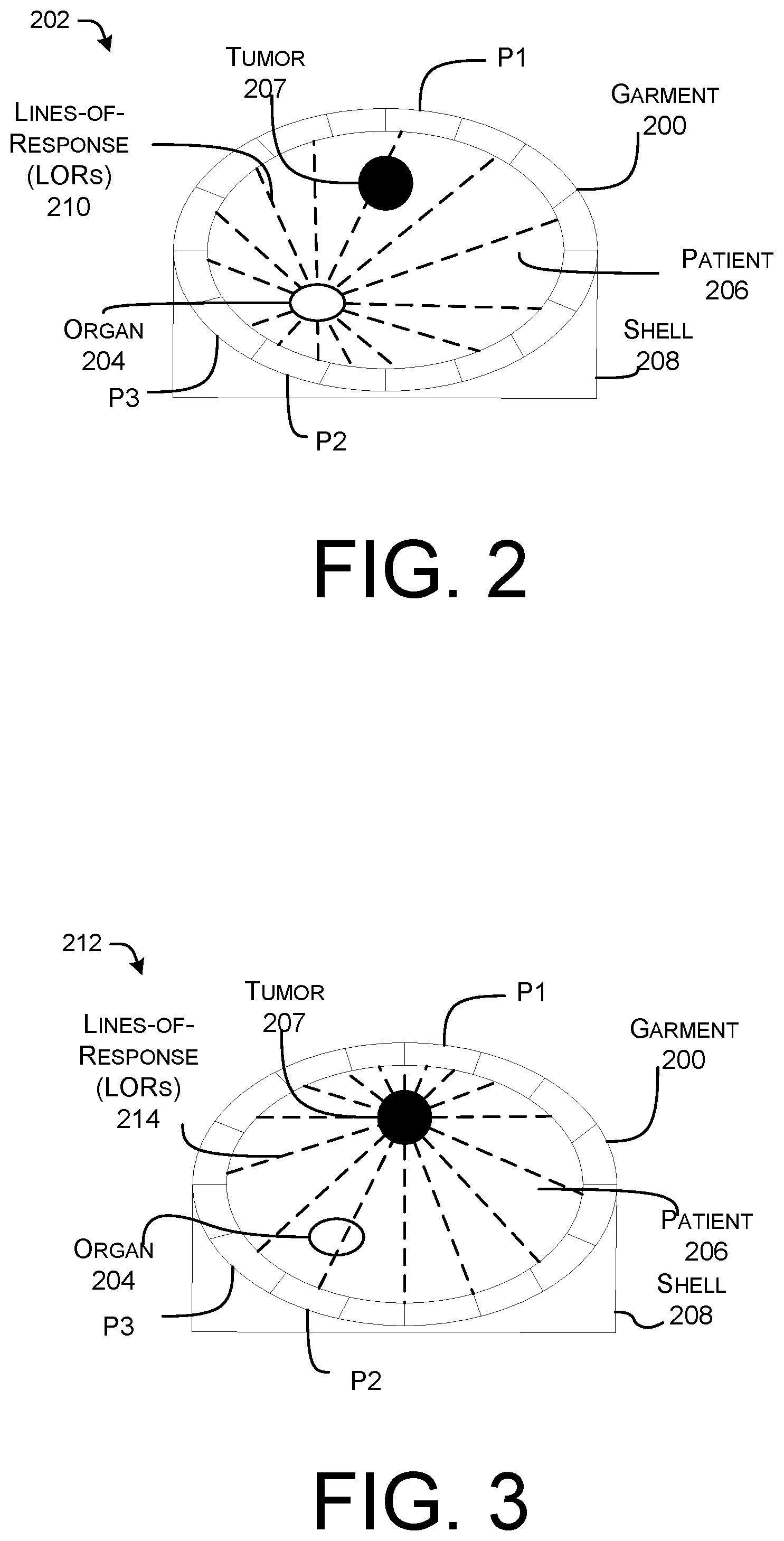 Patent US12377289 Figure 2 – Devices, systems, and methods for personalized dosimetry