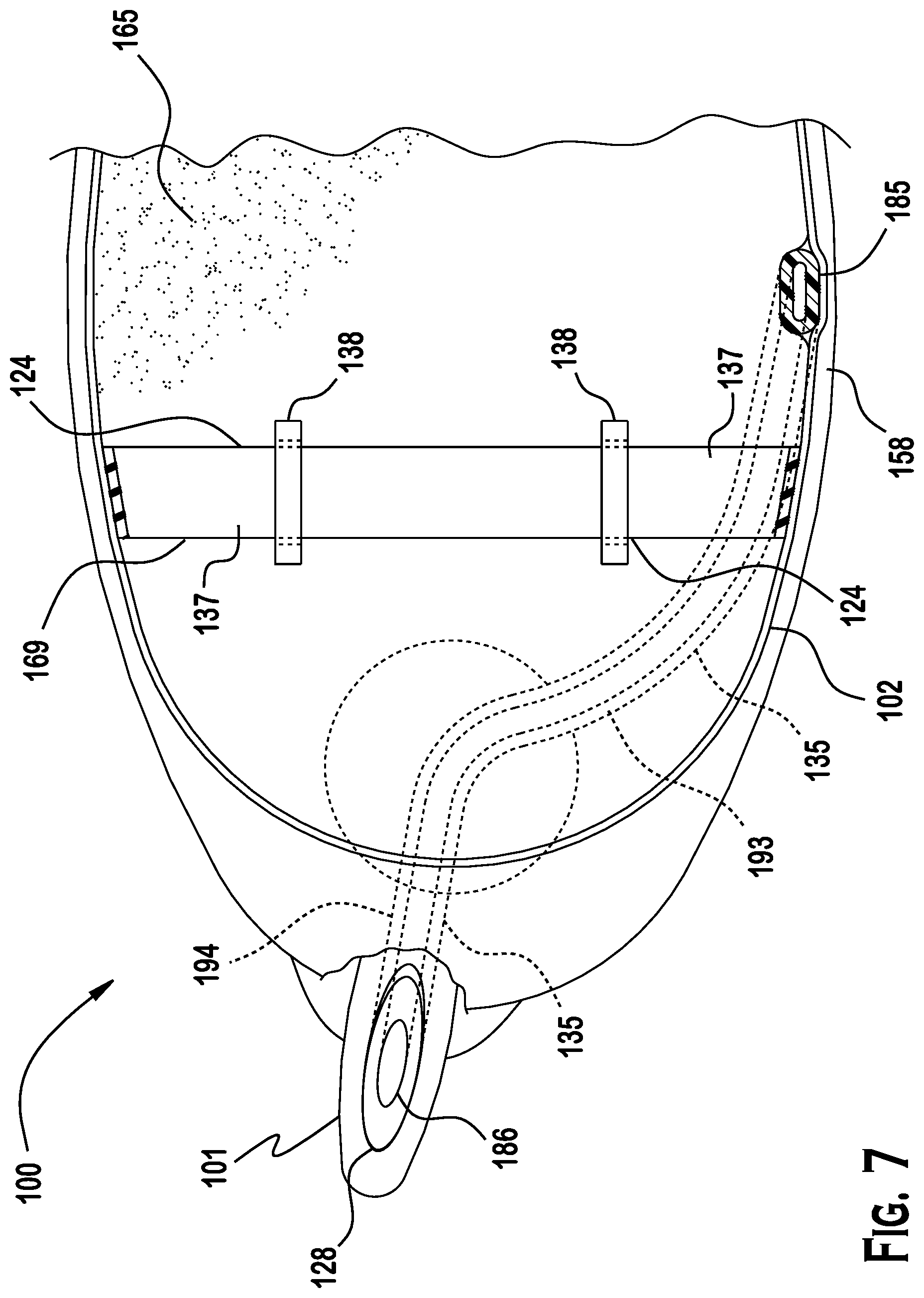 Patent US12377319 Figure 6 – Floatable breathing device