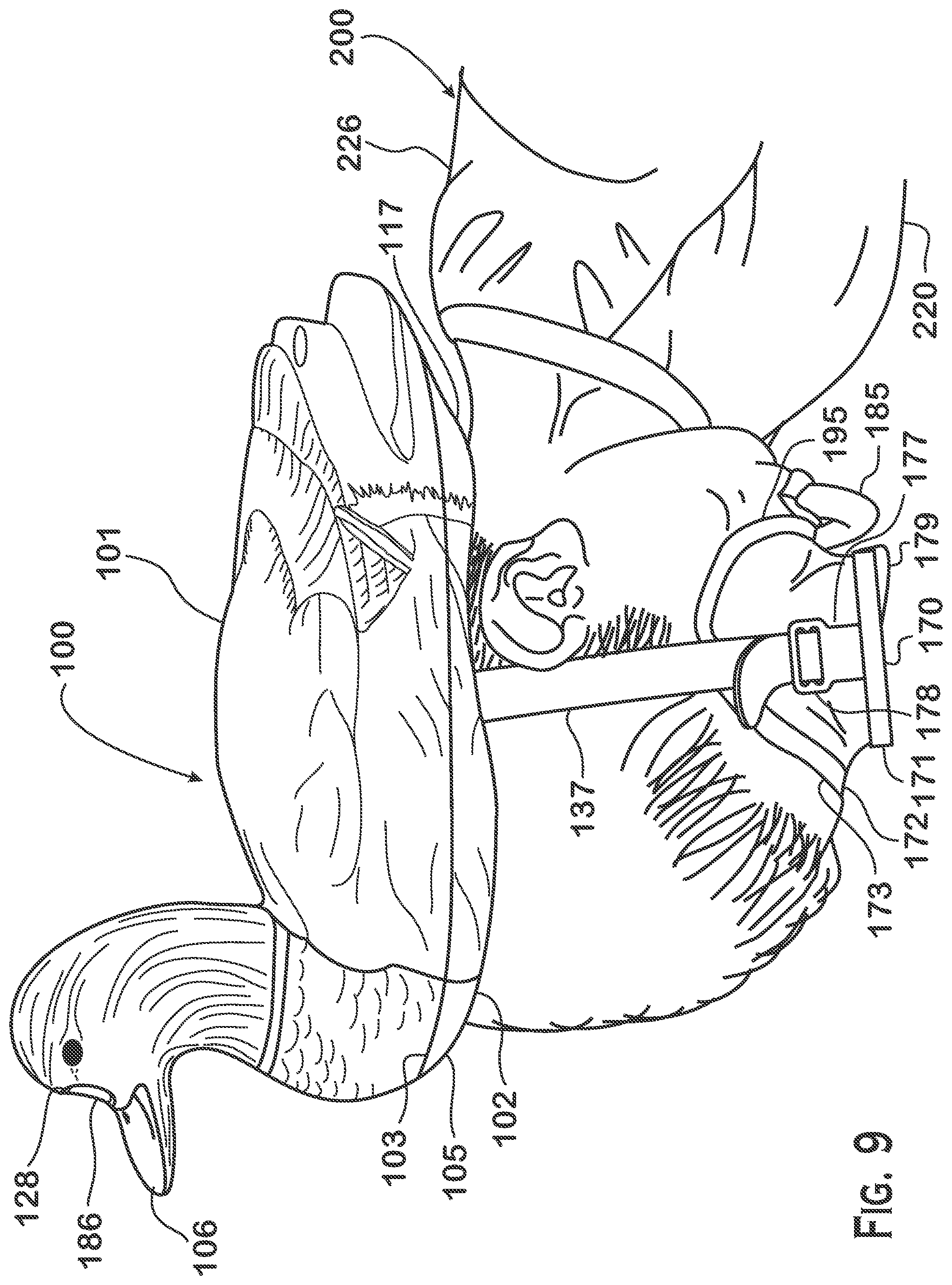 Patent US12377319 Figure 8 – Floatable breathing device