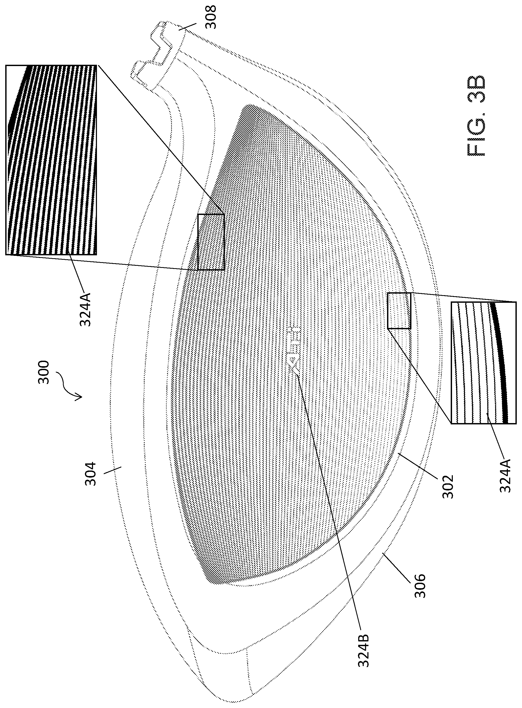 Patent US12377321 Figure 4 – Laser-contrasted golf club head and manufacturing process